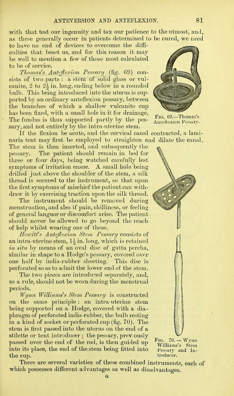 Fig. 69.—Thomas's Anteflexion Fessarv. \ with that test our ingenuity and tax our patience to the utmost, and, as these generally occur in patients determined to be cured, we need to have no end of devices to overcome the diiE- culties that beset us, and for this reason it may be well to mention a few of those most calculated to be of service. Thomas's Anteflexion Pessary (fig. 69) con- sists of two parts : a stem of solid glass or vul- canite, 2 to 2^ in. long, ending below in a rounded bulb. This being introduced into the uterus is sup- ported by an ordinaiy anteflexion pessary, between the branches of which a shallow vulcanite cup has been fixed, with a small hole in it for drainage. The fundus is thus supported partly by the pes- sary, and not entirely by the intra-uterine stem. If the flexion be acute, and the cervical canal contracted, a lami- naria tent may first be employed to straighten and dilate the canal. The stem is then inserted, and subsequently the pessary. The patient should remain in bed for % three or four days, being watched carefully lest ^ symptoms of irritation ensue. A small hole being drilled just above the shoulder of the stem, a silk thread is secured to the instrument, so that u|3on the first symptoms of mischief the patient can with- draw it by exercising traction upon the silk thread. The instrument should be removed during menstruation, and also if pain, chilliness, or feeling of general languor or discomfort arise. The patient should never be allowed to go beyond the x-each of help whilst wearing one of these. Heiijitt's Anteflexion Stem Fessary consists of an intra-uterine stem, 1^ in. long, which is retained in situ by means of an oval disc of gutta percha, similar in shape to a Hodge's pessary, covered over one half by india-rubber sheeting. This disc is perforated so as to admit the lower end of the stem. The two pieces are introduced separately, and, as a rule, should not be worn during the menstrual periods. Wyom Williams's Stem Pessary is constructed on the same principle : an intra-uterine stem being suppoited on a Hodge, covei'ed with a dia- phragm of perforated india-rubber, the bulb resting in a kind of socket or perforated cup (fig. 70). The stem is first passed into the uterus on the end of a stilette or tent introducer ; the pessary, prev.ously passed over the end of the rod, is then guided up into its place, the end of the stem being fitted into the cup. There are several varieties of these combined instruments, each of which possesses different advantages as well as disadvantages. G Fig. 70. — Wynn Williams's Stem Pessary and In- troducer.