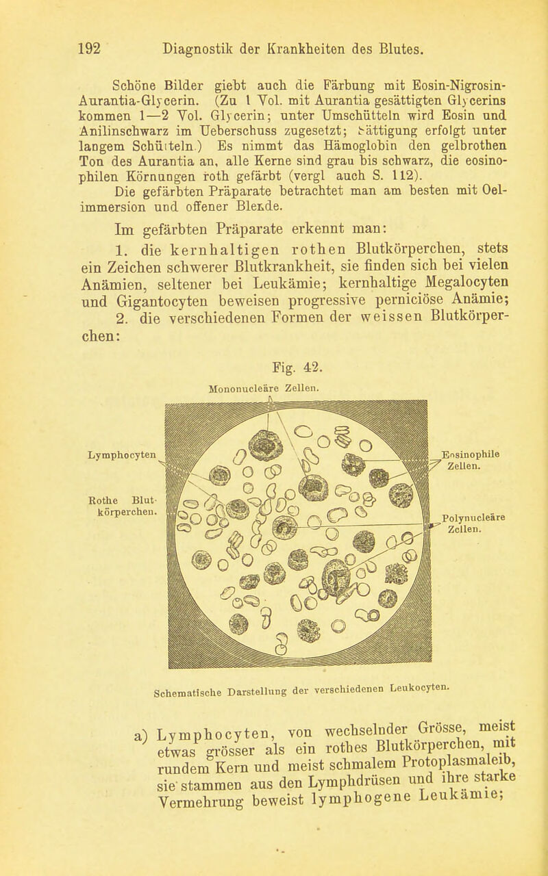 Schöne Bilder giebt auch die Färbung mit Eosin-Nigrosin- Aurantia-Glycerin. (Zu 1 Vol. mit Aurantia gesättigten Gl> cerins kommen 1—2 Vol. Glycerin; unter Umschütteln wird Eosin und Anilinschwarz im Ueberschuss zugesetzt; t-ättigung erfolgt unter langem Schütteln) Es nimmt das Hämoglobin den gelbrothen Ton des Aurantia an. alle Kerne sind grau bis schwarz, die eosino- philen Körnangen roth gefärbt (vergl auch S. 112). Die gefärbten Präparate betrachtet man am besten mit Oel- immersion und offener Blende. Im gefärbten Präparate erkennt man: 1. die kernhaltigen rothen Blutkörperchen, stets ein Zeichen schwerer Blutkrankheit, sie finden sich bei vielen Anämien, seltener bei Leukämie; kernhaltige_ Megalocyten und Gigantocyten beweisen progressive perniciöse Anämie; 2. die verschiedenen Formen der weissen Blutkörper- chen: a) Lymphocyten, von wechselnder Grosse, meist etwas grösser als ein rotbes Blutkörperchen, mit rundem Kern und meist schmalem Protoplasmaleib, sie stammen aus den Lymphdrüsen und ihre starke Vermehrung beweist lymphogene Leukämie;
