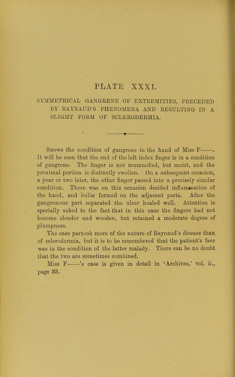 SYMMETEICAL GANGRENE OF EXTEEMITIES, PEECEDED BY RAYNAUD'S PHENOMENA AND RESULTING IN A SLIGHT POEM OF SCLERODBRMIA. ♦ Shows the condition of gangrene in the hand of Miss F . It will be seen that the end of the left index finger is in a condition of gangrene. The finger is not mummified, but moist, and the proximal portion is distinctly swollen. On a subsequent occasion, a year or two later, the other finger passed into a precisely similar condition. There was on this occasion decided inflammation of the hand, and bullae formed on the adjacent parts. After the gangrenous part separated the ulcer healed well. Attention is specially asked to the fact that in this case the fingers had not become slender and wooden, but retained a moderate degree of plumpness. The case partook more of the nature of Raynaud's disease than of sclerodermia, but it is to be remembered that the patient's face was in the condition of the latter malady. There can be no doubt that the two are sometimes combined. Miss F 's case is given in detail in 'Archives,' vol. ii., page 33.