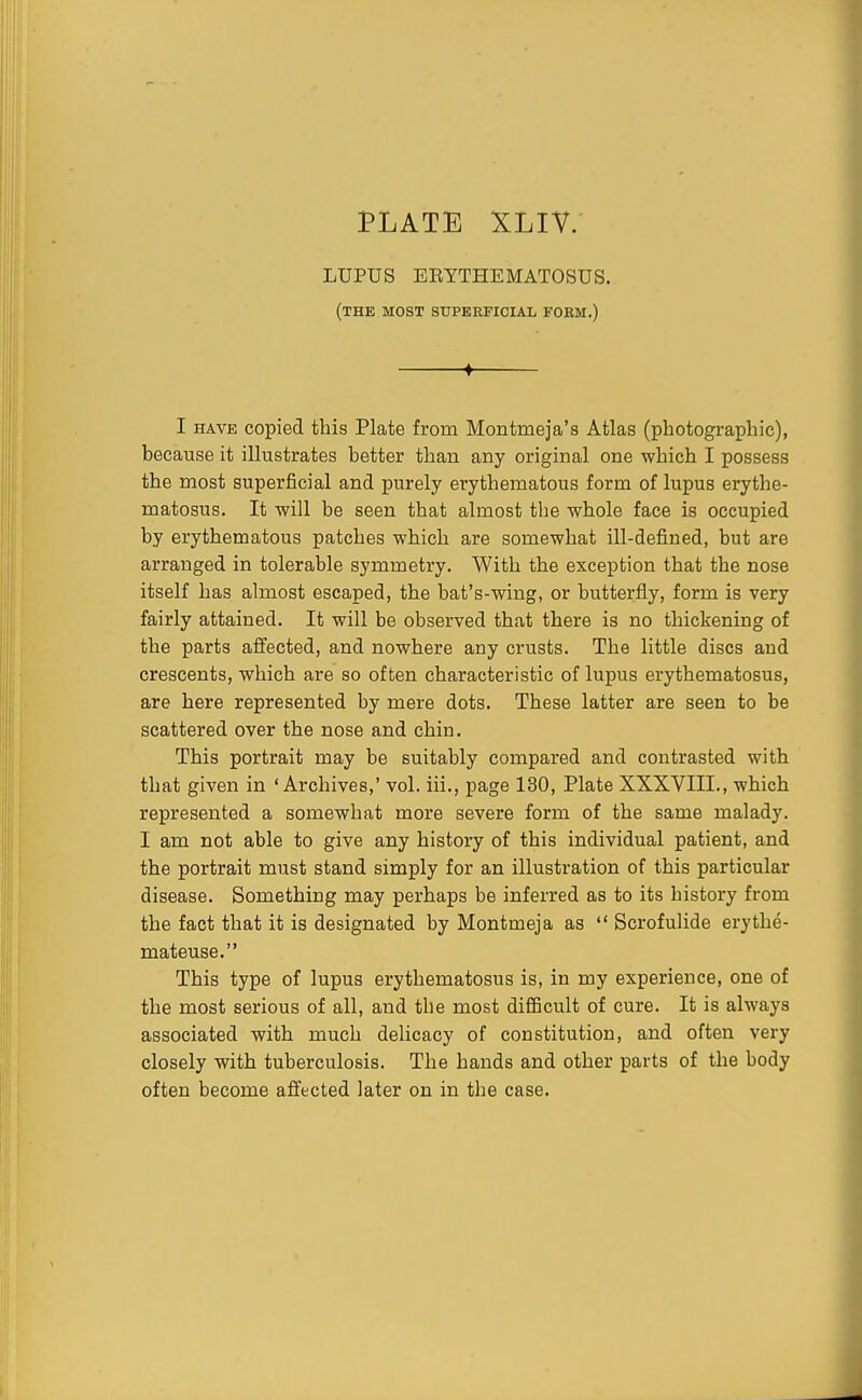 LUPUS ERYTHEMATOSUS. (the most superficial form.) f I HAVE copied this Plate from Montmeja's Atlas (photographic), because it illustrates better than any original one which I possess the most superficial and purely erythematous form of lupus erythe- matosus. It will be seen that almost the whole face is occupied by erythematous patches which are somewhat ill-defined, but are arranged in tolerable symmetry. With the exception that the nose itself has almost escaped, the bat's-wing, or butterfly, form is very fairly attained. It will be observed that there is no thickening of the parts affected, and nowhere any crusts. The little discs and crescents, which are so often characteristic of lupus erythematosus, are here represented by mere dots. These latter are seen to be scattered over the nose and chin. This portrait may be suitably compared and contrasted with that given in 'Archives,' vol. iii., page 130, Plate XXXVIII., which represented a somewhat more severe form of the same malady. I am not able to give any history of this individual patient, and the portrait must stand simply for an illustration of this particular disease. Something may perhaps be inferred as to its history from the fact that it is designated by Montmeja as  Scrofulide erythe- mateuse. This type of lupus erythematosus is, in my experience, one of the most serious of all, and the most difficult of cure. It is always associated with much delicacy of constitution, and often very closely with tuberculosis. The hands and other parts of the body often become affected later on in the case.