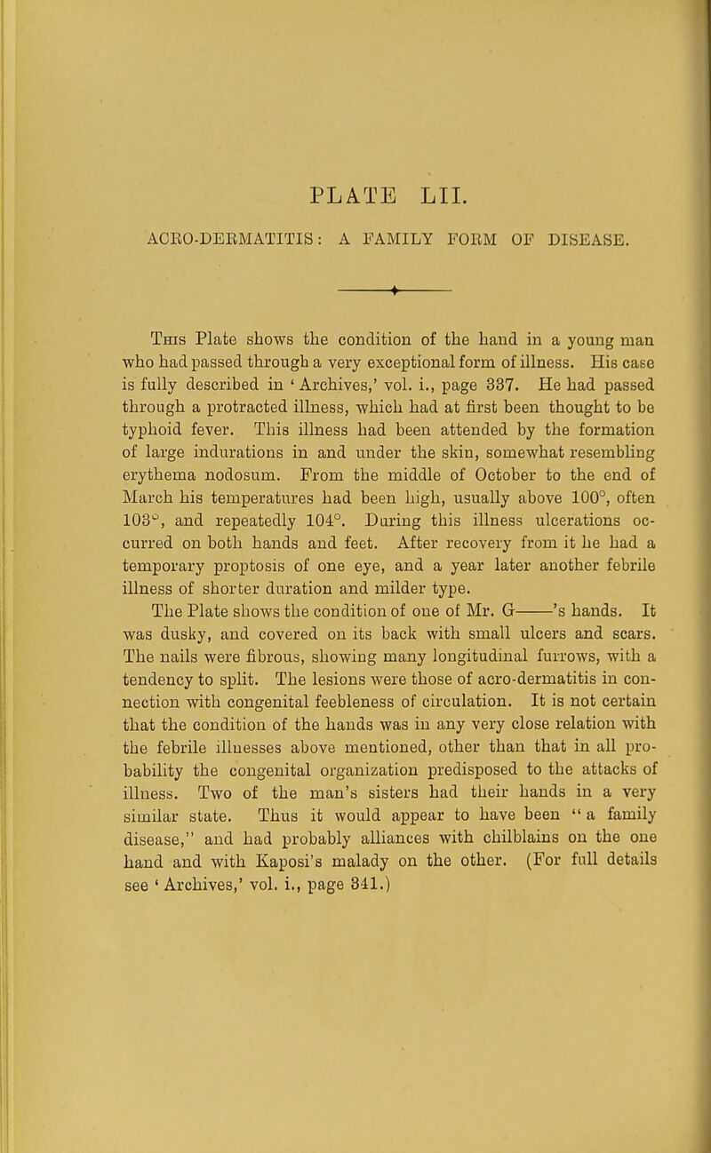 ACEO-DEEMATITIS: A FAMILY FORM OF DISEASE. ♦ This Plate shows the condition of the hand in a young man who had passed through a very exceptional form of illness. His case is fully described in ' Archives,' vol. i., page 337. He had passed through a protracted illness, which had at first been thought to be typhoid fever. This illness had been attended by the formation of large indurations in and under the skin, somewhat resembUng erythema nodosum. From the middle of October to the end of March his temperatures had been high, usually above 100°, often 103^, and repeatedly 104°. Daring this illness ulcerations oc- curred on both hands and feet. After recovery from it he had a temporary proptosis of one eye, and a year later another febrile illness of shorter duration and milder type. The Plate shows the condition of one of Mr. G 's hands. It was dusky, and covered on its back with small ulcers and scars. The nails were fibrous, showing many longitudinal furrows, with a tendency to split. The lesions were those of acro-dermatitis in con- nection with congenital feebleness of circulation. It is not certain that the condition of the hands was in any very close relation with the febrile illnesses above mentioned, other than that in all pro- bability the congenital organization predisposed to the attacks of illness. Two of the man's sisters had their hands in a very similar state. Thus it would appear to have been  a family disease, and had probably alliances with chilblains on the one hand and with Kaposi's malady on the other. (For full details see ' Archives,' vol. 1., page 341.)