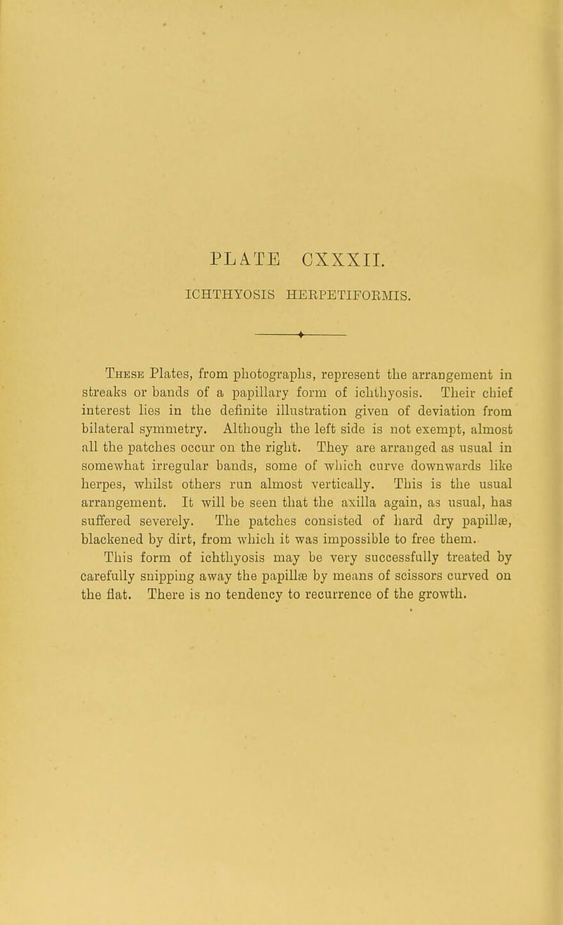 ICHTHYOSIS HEEPETIFOEMIS. ♦ These Plates, from photographs, represent the arrangement in streaks or bands of a papillary form of ichthyosis. Their chief interest lies in the definite illustration given of deviation from bilateral symmetry. Although the left side is not exempt, almost all the patches occur on the right. They are arranged as usual in somewhat irregular bands, some of which curve downwards like herpes, whilst others run almost vertically. This is the usual arrangement. It will be seen that the axilla again, as usual, has suffered severely. The patches consisted of hard dry papillae, blackened by dirt, from which it was impossible to free them. This form of ichthyosis may be very successfully treated by carefully snipping away the papillae by means of scissors curved on the fiat. There is no tendency to recurrence of the growth.
