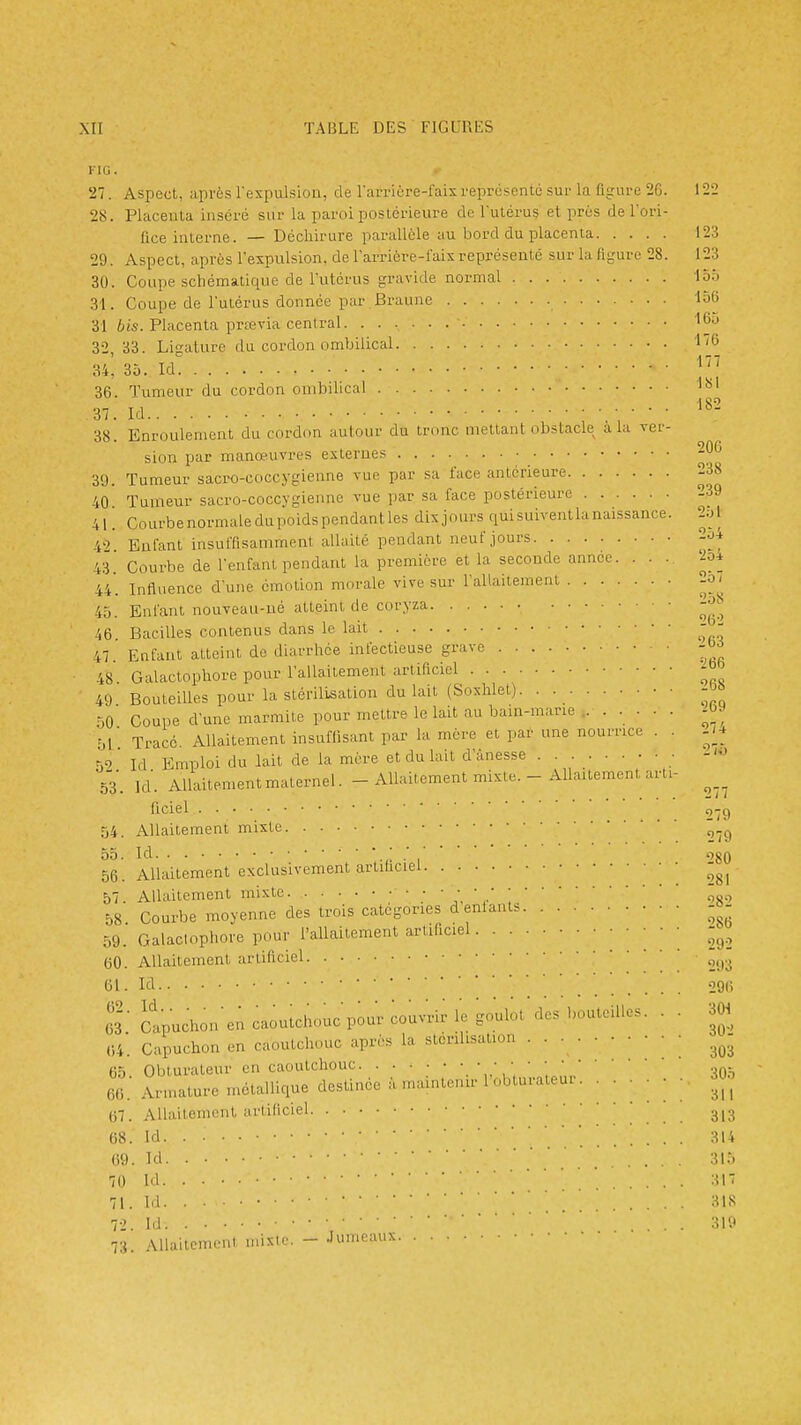 i-ia. 27. Aspect, après l'expulsion, de rarriére-fais représente sur la figure 2G. 122 28. Placenta inséré sur la paroi postérieure de lutérug et prés de l'ori- fice interne. — Déchirure parallèle au bord du placenta 123 29. Aspect, après l'expulsion, de larrière-l'aix représente sur la figure 28. 123 30. Coupe schématique de l'utérus gravide normal ioh 31. Coupe de l'utérus donnée par Braune loS 31 Placenta prtevia central l*^'- 32. 33. Ligature du cordon ombilical l'G 34^ 30- W 36. Tumeur du cordon ombilical 37. Id 38. Enroulement du cordon autour du tronc mettant obstacle a la ver- sion par manœuvres externes -^^ 39. Tumeur sacro-coccygienne vue par sa face antérieure 238 40 Tumeur sacro-coccygienne vue par sa face postérieure 239 41. Courbenormaledupoidspendantles dixjours quisuiventlaaaissance. 2ol 42 Enfant insuffisamment allaité pendant neuf jours 2o4 43. Courbe de l'enfant pendant la première et la seconde année. ... U. Influence dune émotion morale vive sur l'allaitement 2o/ 45. Enfant nouveau-né atteint de coryza -^^ 46 Bacilles contenus dans le lait - - 47. Enfant atteint de diarrhée infectieuse grave -oj 48 Galaclophore pour l'allaitement artificiel ^ ' 49 Bouteilles pour la stérilisation du lait (Soxhlet). . 50 Coupe d'une marmite pour mettre le lait au bain-marie ....... -OW 51 ■ Tracé Allaitement insuffisant par la mère et par une nourrice . . ./4 n9 Id Emploi du lait de la mère et du lait d'ànesse • 53. Id. Allaitement maternel. - Allaitement mixte. - Allaitement arti- ficiel q-g 54. Allaitement mixte ^.^ 55. Id H • 1 ' ''80 56. Allaitement exclusivement artiticiei -^^ 57. Allaitement mixte ôso 58. Courbe moyenne des trois catégories déniants - - 59. Galactophore pour l'allaitement artificiel ; ' ; .' 292 60. Allaitement artificiel 61. Id 296 es' Jîipuchon'en caoutchouc pou; coa^rU: le go;.^. des bouteilles. . . 3W ,i4'. Capuchon en caoutchouc après la stérilisation ■ • 65 Obturateur en caoutchouc  30.5 66 Armature métallique destinée à maintenu-l'obturateur. ...... 30.' (37. Allaitement artificiel 3,3