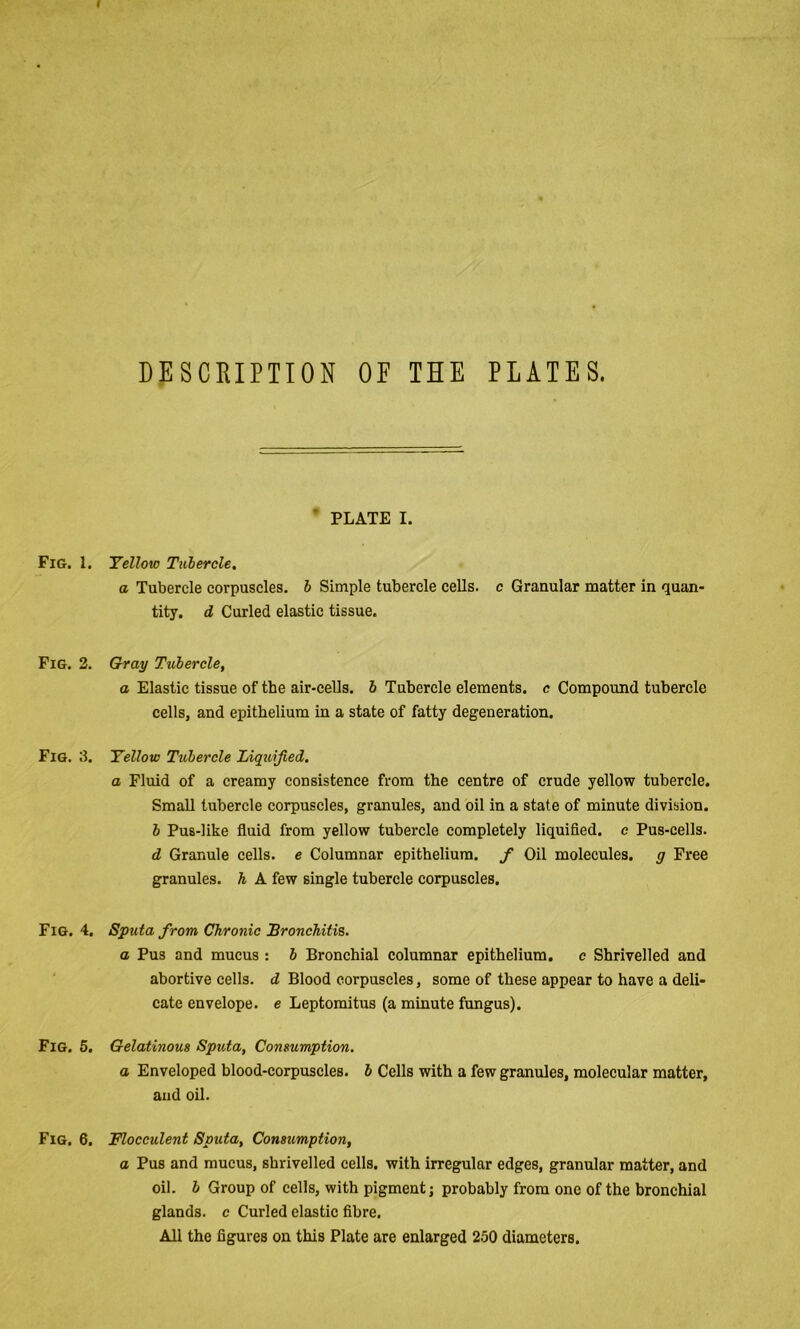 DESCRIPTION OF THE PLATES. Fig. 1 Fig. 2, Fig. 2, Fig. 4. Fig. 5, Fig. 6, * PLATE I. Yellow Tubercle, a Tubercle corpuscles, h Simple tubercle cells, c Granular matter in quan- tity. d Curled elastic tissue. Gh-ay Tubercle, a Elastic tissue of the air-cells, b Tubercle elements, c Compound tubercle cells, and epithelium in a state of fatty degeneration. Yellow Tubercle Liquified. a Fluid of a creamy consistence from the centre of crude yellow tubercle. Small tubercle corpuscles, granules, and oil in a state of minute division. b Pus-like fluid from yellow tubercle completely liquified, c Pus-cells. d Granule cells, e Columnar epithelium, f Oil molecules, g Free granules, h A few single tubercle corpuscles. Sputa from Chronic Bronchitis. a Pus and mucus : b Bronchial columnar epithelium. c Shrivelled and abortive cells, d Blood corpuscles, some of these appear to have a deli- cate envelope, e Leptomitus (a minute fungus). Gelatinous Sputa, Consumption. a Enveloped blood-corpuscles, b Cells with a few granules, molecular matter, and oil. Flocculent Sputa, Consumption, a Pus and mucus, shrivelled cells, with irregular edges, granular matter, and oil. b Group of cells, with pigment j probably from one of the bronchial glands, c Curled elastic fibre. All the figures on this Plate are enlarged 250 diameters.