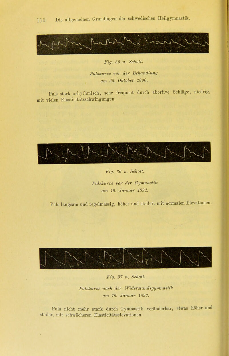 Pulskurve vor der Behandlung am 25. Oktober 1890. Puls stark arhythmisck, sehr frequent durch abortive Schläge, niedrig, mit vielen Elasticitätsschwingungen. Fig. 36 n. Schott. Pulskurve vor der Gymnastik am 16. Januar 1891. Puls langsam und regelmässig, höher und steiler, mit normalen Elevationen. Fig. 37 n. Schott. Pulskurve nach der Widerstandsgijmnastik am 16. Januar 1891. Puls nicht mehr stark durch Gymnastik veränderbar, etwas höher und steiler, mit schwächeren Elasticitätselevationen.