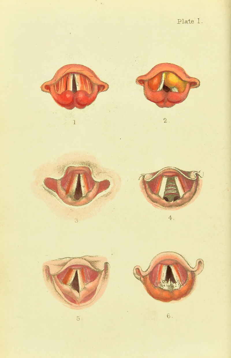 Plate 1. 5 6