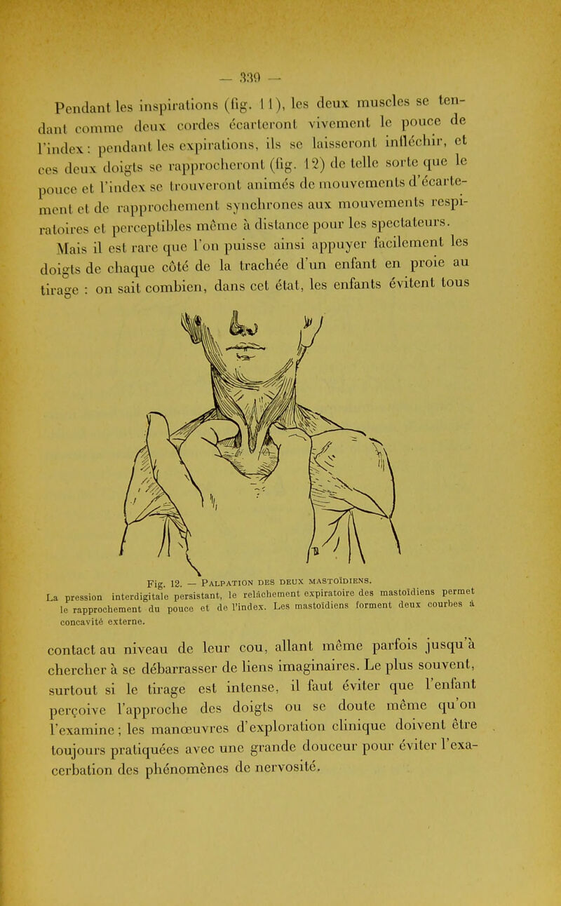 Pendant les inspirations (fig. 11), les deux muscles se ten- dant comme deux cordes écarteront vivement le pouce de l'index : pendant les expirations, ils se laisseront inlléchir, et ces deux doigts se rapprocheront (fig. 12) de telle soi-te que le pouce et l'index se trouveront animés de mouvements d'écarte- ment et de rapprochement synchrones aux mouvements respi- ratoires et perceptibles même à distance pour les spectateurs. Mais il est rare que l'on puisse ainsi appuyer facilement les doigts de chaque côté de la trachée d'un enfant en proie au tirage : on sait combien, dans cet état, les enfants évitent tous Fig. 12. — Palpation des deux mastoïdiens. La pression InterdigitaTe persistant, le relâchement expiratoire des mastoïdiens permet le rapprochement du pouce et de l'index. Les mastoïdiens forment deux courbes a concavité externe. contact au niveau de leur cou, allant même parfois jusqu'à chercher à se débarrasser de liens imaginaires. Le plus souvent, surtout si le tirage est intense, il faut éviter que l'enfant perçoive l'approche des doigts ou se doute même qu'on l'examine; les manœuvres d'exploration clinique doivent être toujours pratiquées avec une grande douceur pour éviter l'exa- cerbation des phénomènes de nervosité.