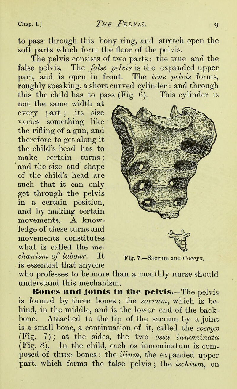 to pass through this bony ring, and stretch open the soft parts which form the floor of the pelvis. The pelvis consists of two parts : the true and the false pelvis. The false pelvis is the expanded upper part, and is open in front. The true pelvis forms, roughly speaking, a short curved cylinder : and through this the child has to pass (Fig. 6). This cylinder is not the same width at every part ; its size varies something like the rifling of a gun, and therefore to get along it the child's head has to make certain turns; and the size and shape of the child's head are such that it can only get through the pelvis in a certain position, and by making certain movements. A know- ledge of these turns and movements constitutes what is called the me- chanism of labour. It is essential that anyone who professes to be more than a monthly nurse should understand this mechanism. Bones and joints in the pelvis.—The pelvis is formed by three bones : the sacrum, which is be- hind, in the middle, and is the lower end of the back- bone. Attached to the tip of the sacrum by a joint is a small bone, a continuation of it, called the coccyx (Fig. 7); at the sides, the two ossa innominata (Fig. 8). In the child, each os innominatum is com- posed of three bones : the ilium, the expanded upper part, which forms the false pelvis; the ischium, on Fig. 7.—Sacrum and Coccyx.