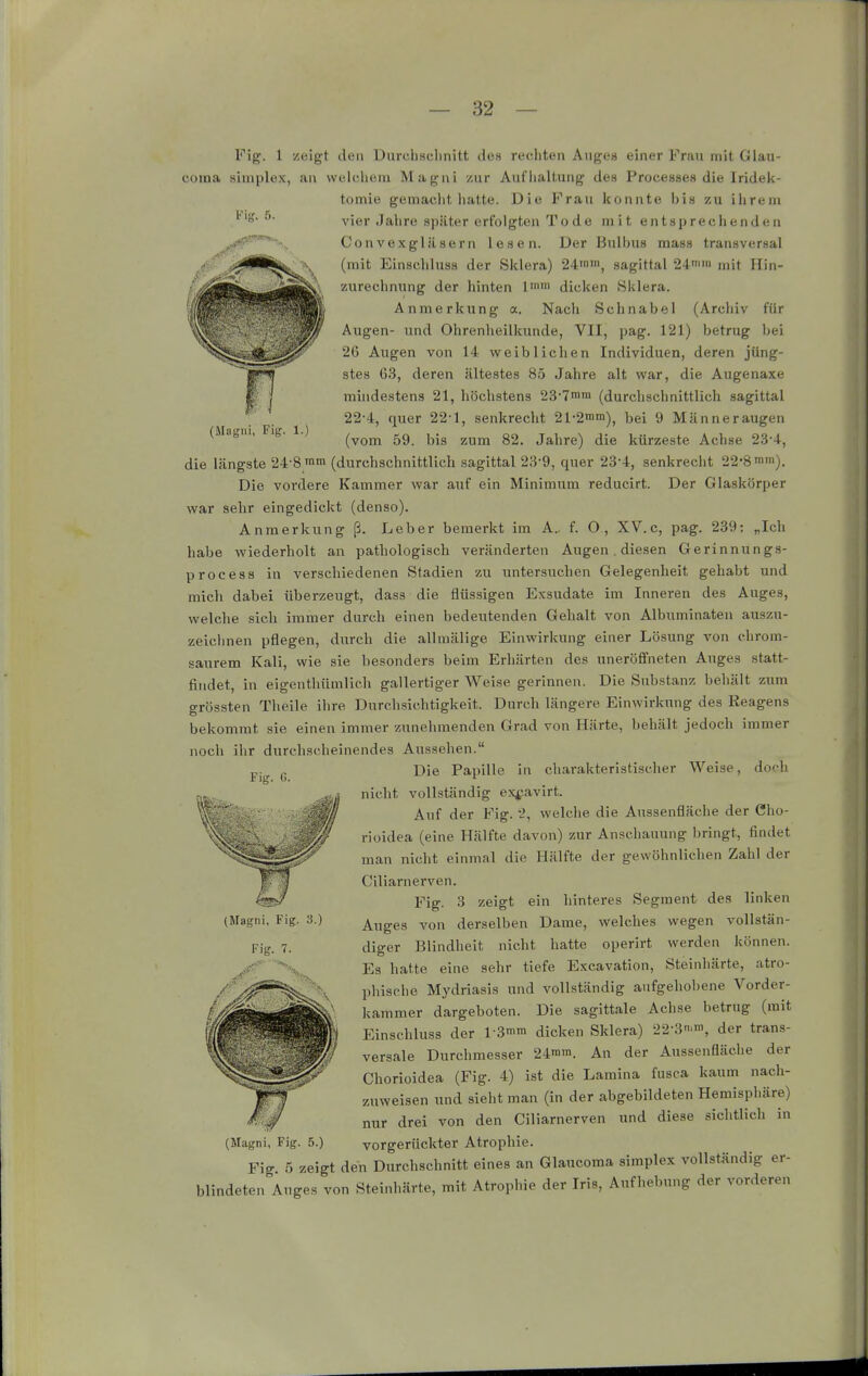 Vis. (>■ (Magni, Fig. 1.) Fig. 1 zeigt den Durehsclinitt des rechten Auges einer Frau mit Glau- coina Simplex, an welchem Magni zur Auflialtung des Processes die Irideli- tomie gemaciit iiatte. Die Frau Iconnte his zu ihrem vier Jahre später erfolgten To de mit entsprechenden Convexgläsern lesen. Der Bulbus mass transversal (mit Einscliluss der Sklera) 24'nin, sagittal 24iin ,y,it Hin- zurechnung der hinten 1 dicken .Sklera. Anmerkung a. Nach Schnabel (Archiv für Augen- und Ohrenheilkunde, VII, pag. 121) betrug bei y 2G Augen von 14 weiblichen Individuen, deren jüng- stes 63, deren ältestes 85 Jahre alt war, die Augenaxe mindestens 21, höchstens 237inin (durchschnittlich sagittal 22-4, quer 22-1, senkrecht 21-2n'n>), bei 9 Männeraugen (vom 59. bis zum 82. Jahre) die kürzeste Achse 23'4, die längste 24-8'nm (durchschnittlich sagittal 23-9, quer 23-4, senkrecht 22-8 mm). Die vordere Kammer war auf ein Minimum reducirt. Der Glaskörper war sehr eingedickt (denso). Anmerkung ß. Leber bemerkt im A., f. O, XV.c, pag. 239: „Ich habe wiederholt an pathologisch veränderten Augen. diesen Gerinnungs- process in verschiedenen Stadien zu untersuchen Gelegenheit gehabt und mich dabei überzeugt, dass die flüssigen Exsudate im Inneren des Auges, welche sich immer durch einen bedeutenden Gehalt von Albuminaten auszu- zeichnen pflegen, durch die allmälige Einwirkung einer Lösung von chrom- saurem Kali, wie sie besonders beim Erliärten des uneröfifneten Auges statt- findet, in eigenthümlich gallertiger Weise gerinnen. Die Substanz behält zum grössten Theile ihre Durchsichtigkeit. Durch längere Einwirkung des Reagens bekommt sie einen immer zunehmenden Grad von Härte, behält jedoch immer noch ihr durchscheinendes Aussehen. Die Papille in charakteristischer Weise, doch nicht vollständig exfavirt. Auf der Fig. 2, welche die Aussenfläche der Cho- rioidea (eine Hälfte davon) zur Anschauung bringt, findet man nicht einmal die Hälfte der gewöhnlichen Zahl der Ciliarnerven. Fig. 3 zeigt ein hinteres Segment des linken Auges von derselben Dame, welches wegen vollstän- diger Blindheit nicht hatte operirt werden können. Es hatte eine sehr tiefe Excavation, Steinhärte, atro- phische Mydriasis und vollständig aufgehobene Vorder- kammer dargeboten. Die sagittale Achse betrug (mit Einschluss der l-3>in dicken Sklera) 22-3n.in, der trans- versale Durchmesser 24nim. Au der Aussenfläche der Chorioidea (Fig. 4) ist die Lamina fusca kaum nach- zuweisen und sieht man (in der abgebildeten Hemisphäre) nur drei von den Ciliarnerven und diese sichtlich in vorgerückter Atrophie. Fig 5 zeigt den Durchschnitt eines an Glaucoma simplex vollständig er- blindeten Auges von Steinhärte, mit Atrophie der Iris, Aufhebung der vorderen Fig. C. (Magni, Fig. 5.)