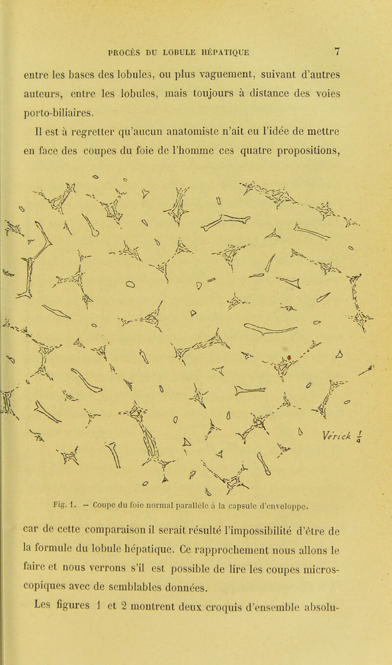 entre les bases des lobules, ou plus vaguement, suivant d'autres auteurs, entre les lobules, mais toujours à distance des voies porto-biliaires. Il est à regretter qu'aucun anatomiste n'ait eu l'idée de mettre en face des coupes du foie de l'homme ces quatre propositions, k.V H ■ 1 ^ ^ 16 a» v- .fA ~C / «s A ^ \ X vr- Fig. 1. - Coupe du foie normal parallèle à la capsule d'enveloppe. car de cette comparaison il serait résulté l'impossibilité d'être de la formule du lobule hépatique. Ce rapprochement nous allons le faire et nous verrons s'il est possible de lire les coupes micros- copiques avec de semblables données. Les figures 1 et 2 montrent deux croquis d'ensemble absolu-