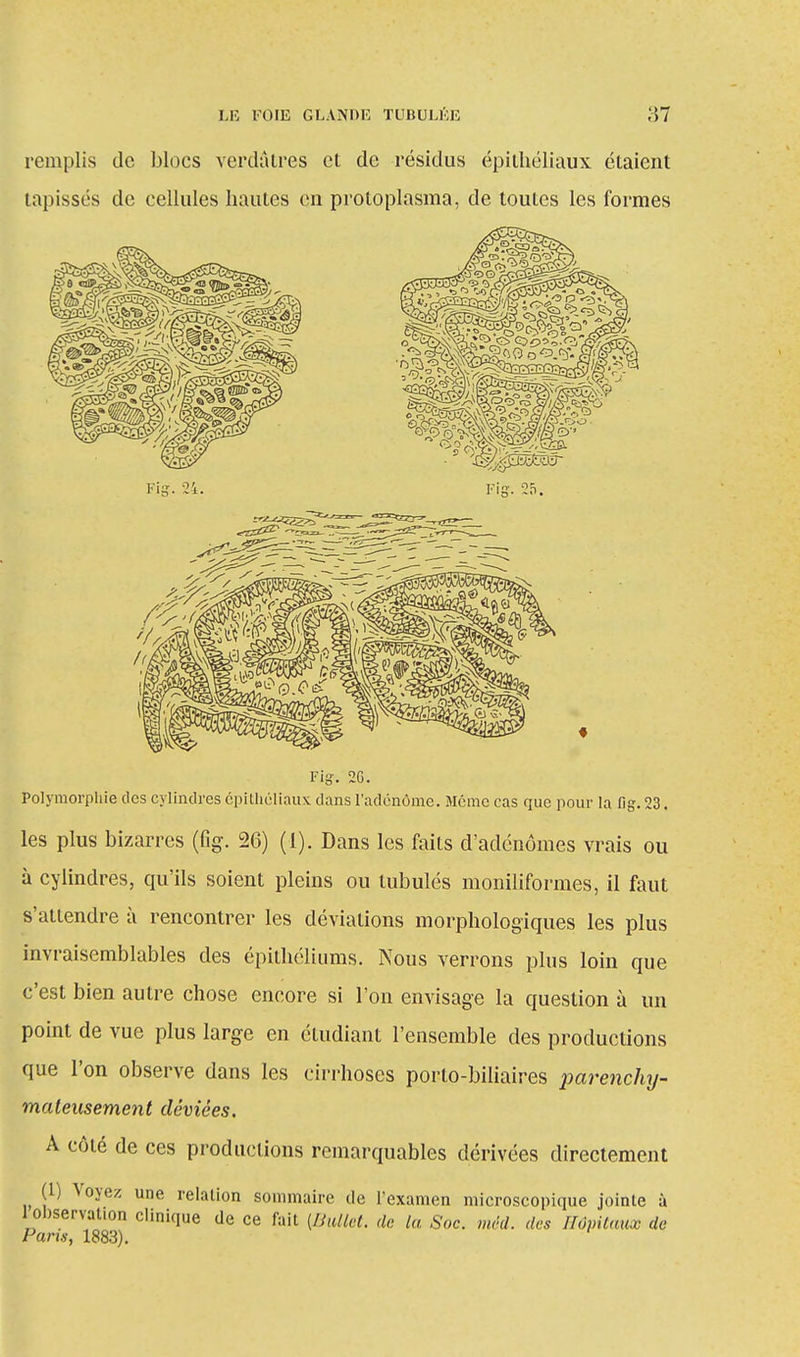 remplis de blocs verdâtres et de résidus épithéliaux étaient tapissés de cellules hautes en proto-plasma, de toutes les formes Fis. 24. Fig. 2G. Polymorphie des cylindres épithéliaux dans l'adénome. Même cas que pour la fig. 23. les plus bizarres (fig. 26) (1). Dans les faits d'adénomes vrais ou à cylindres, qu'ils soient pleins ou tubulés moniliformes, il faut s'attendre à rencontrer les déviations morphologiques les plus invraisemblables des épithéliums. Nous verrons plus loin que c'est bien autre chose encore si l'on envisage la question à un point de vue plus large en étudiant l'ensemble des productions que l'on observe dans les cirrhoses porto-biliaires parenchy- maleusement déviées. A côté de ces productions remarquables dérivées directement (1) Voyez une relation sommaire de l'examen microscopique jointe à ^observation clinique de ce fait (Bullet. de la Soc. méd. des Hôpitaux de Pans, 1883).