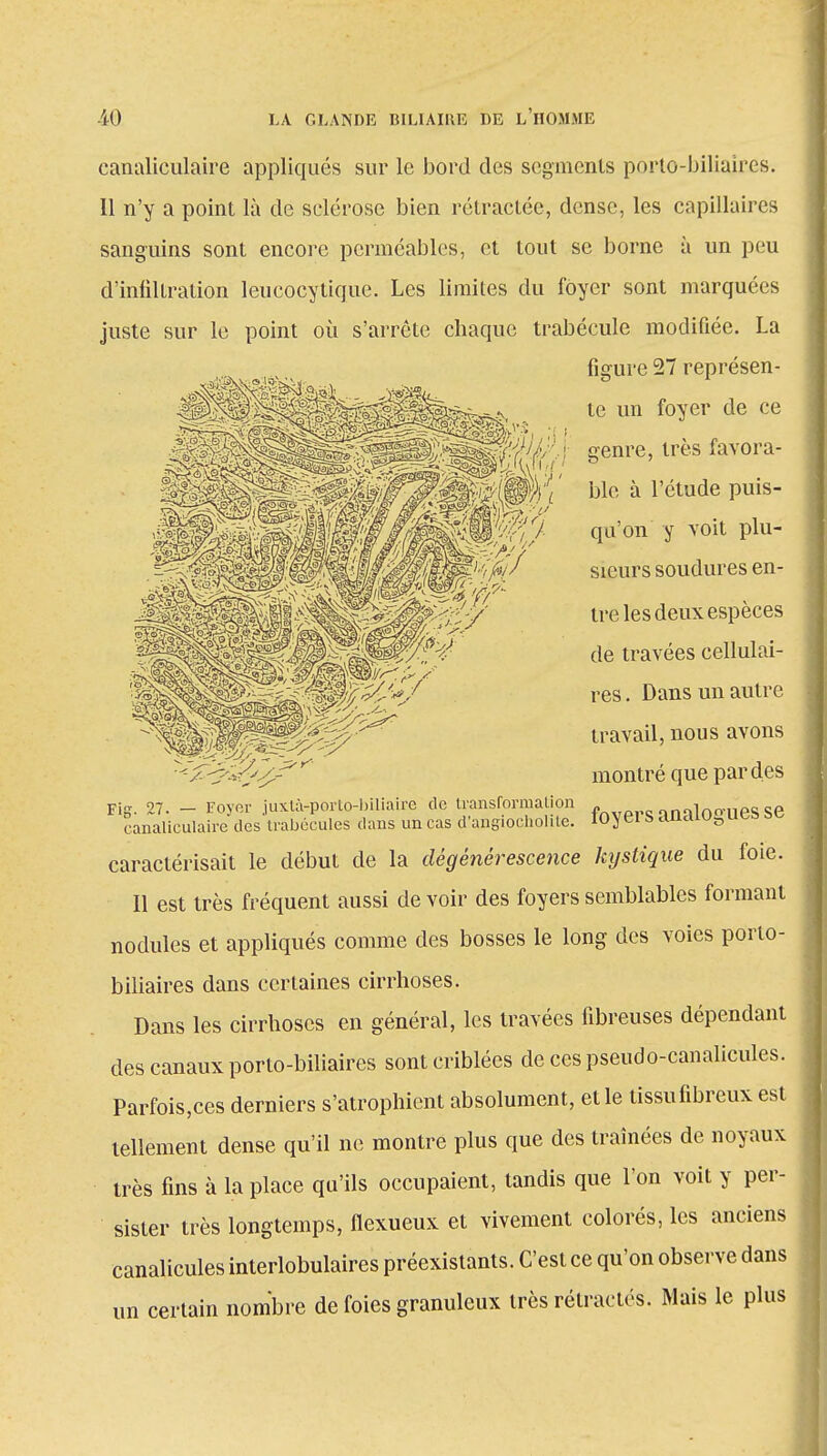canaliculaire appliqués sur le bord des segments porto-biliaires. Il n'y a point là de sclérose bien rétractée, dense, les capillaires sanguins sont encore perméables, et tout se borne à un peu d'infiltration leucocytique. Les limites du foyer sont marquées juste sur le point où s'arrête chaque trabéculc modifiée. La figure 27 représen- te un foyer de ce genre, très favora- ble à l'étude puis- qu'on y voit plu- sieurs soudures en- tre les deux espèces de travées cellulai- res. Dans un autre travail, nous avons montré que par des Fig. 27. - Foyer juxtà-porto-biliaire de transformation amloouesse canaliculaire des trabécules dans un cas d'angioeholile. loyei S analogues se caractérisait le début de la dégénérescence kystique du foie. Il est très fréquent aussi de voir des foyers semblables formant nodules et appliqués comme des bosses le long des voies porto- biliaires dans certaines cirrhoses. Dans les cirrhoses en général, les travées fibreuses dépendant des canaux porto-biliaires sont criblées de ces pseudo-canalicules. Parfois,ces derniers s'atrophient absolument, elle tissu fibreux est tellement dense qu'il ne montre plus que des traînées de noyaux très fins à la place qu'ils occupaient, tandis que l'on voit y per- sister très longtemps, flexueux et vivement colorés, les anciens canalicules interlobulaires préexistants. C'est ce qu'on observe dans un certain nombre de foies granuleux très rétractés. Mais le plus