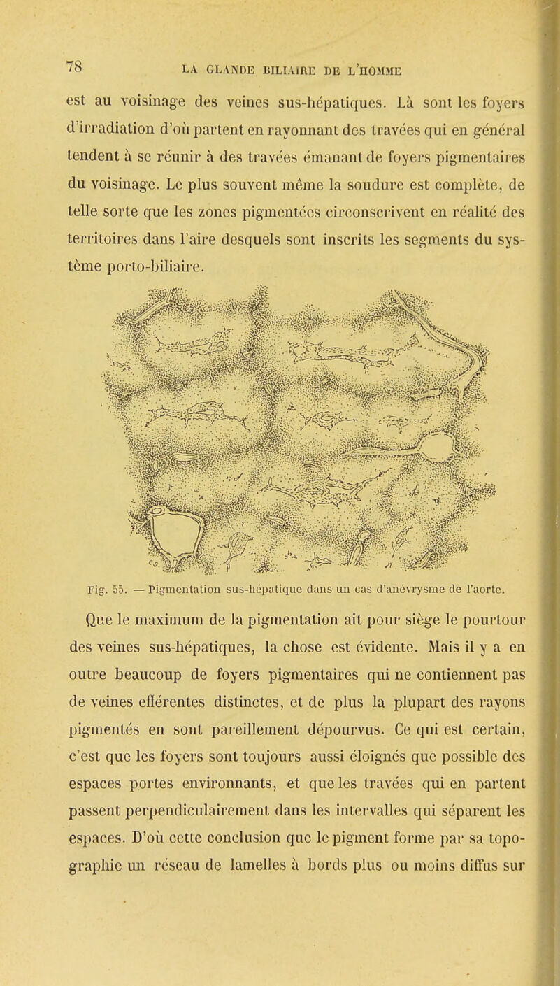 est au voisinage des veines sus-hépatiques. Là sont les foyers d'irradiation d'où partent en rayonnant des travées qui en général tendent à se réunir à des travées émanant de foyers pigmentaires du voisinage. Le plus souvent même la soudure est complète, de telle sorte que les zones pigmentées circonscrivent en réalité des territoires dans l'aire desquels sont inscrits les segments du sys- tème porto-biliaire. Fig. 55. — Pigmentation sus-hépatique dans un cas d'ancvrysme de l'aorte Que le maximum de la pigmentation ait pour siège le pourtour des veines sus-hépatiques, la chose est évidente. Mais il y a en outre beaucoup de foyers pigmentaires qui ne contiennent pas de veines eflérentes distinctes, et de plus la plupart des rayons pigmentés en sont pareillement dépourvus. Ce qui est certain, c'est que les foyers sont toujours aussi éloignés que possible des espaces portes environnants, et que les travées qui en partent passent perpendiculairement dans les intervalles qui séparent les espaces. D'où cette conclusion que le pigment forme par sa topo- graphie un réseau de lamelles à bords plus ou moins diffus sur