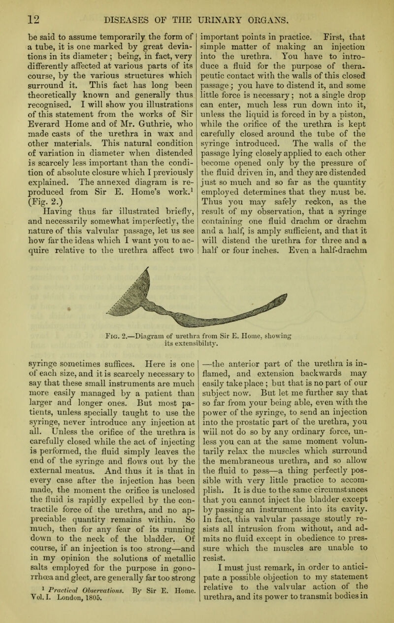 be said to assume temporarily the form of a tube, it is one marked by great devia- tions in its diameter ; being, in fact, very differently affected at various parts of its course, by tlie various structures which surround it. This fact has long been theoretically known and generally thus recognised. I will show you illustrations of this statement from the works of Sir Everard Home and of Mr. Guthrie, who made casts of the urethra in wax and other materials. This natural condition of variation in diameter when distended is scarcely less important than the condi- tion of absolute closure which I previously explained. The annexed diagram is re- produced from Sir E. Home's work.^ (Fig. 2.) Having thus far illustrated briefly, and necessarily somewhat imperfectly, the nature of this valvular passage, let us see how far the ideas which I want you to ac- quire relative to the urethra affect two syringe sometimes suffices. Here is one of each size, and it is scarcely necessary to say that these small instruments are much more easily managed by a patient than larger and longer ones. But most pa- tients, unless specially taught to use the syringe, never introduce any injection at all. Unless the orifice of the urethra is carefully closed while the act of injecting is performed, the fluid simply leaves the end of the syringe and flows out by the external meatus. And thus it is that in every case after the injection has been made, the moment the orifice is unclosed the fluid is rapidly expelled by the con- tractile force of the urethra, and no ap- preciable quantity remains Avithin. So much, then for any fear of its running down to the neck of the bladder. Of course, if an injection is too strong—and in my opinion the solutions of metallic salts employed for the purpose in gono- rrhoja and gleet, are generally far too strong ^ Practical Observations. By Sir E. Home. Vol. I. London, 1805. important points in practice. First, that simple matter of making an injection into the urethra. You have to intro- duce a fluid for the purpose of thera- peutic contact with the walls of this closed passage; you have to distend it, and some little force is necessary; not a single drop can enter, much less run down into it, unless the liquid is forced in by a piston, while the orifice of the i^rethra is kept carefully closed around the tube of the syringe introduced. The w^alls of the passage lying closely applied to each other become opened only by the pressure of the fluid driven in, and they are distended just so much and so far as the quantity employed determines that they must be. Thus you may safely reckon, as the result of my observation, that a syringe containing one fluid drachm or drachm and a half, is amply sufficient, and that it will distend the urethra for three and a half or four inches. Even a half-drachm —the anterior part of the urethra is in- flamed, and extension backwards may easily take place ; but that is no part of our subject now. But let me further say that so far from your being able, even with the power of the syringe, to send an injection into the prostatic part of the urethra, you will not do so by any ordinary force, un- less you can at the same moment volun- tarily relax the muscles which surround the membraneous urethra, and so allow the fluid to pass—a thing perfectly pos- sible with very little practice to accom- plish. It is due to the same circumstances that you cannot inject the bladder except by passing an instrument into its cavity. In fact, this valvular passage stoutly re- sists all intrusion from without, and ad- mits no fluid except in obedience to pres- sure Avhich the muscles are unable to resist. I must just remark, in order to antici- pate a possible objection to my statement relative to the valvular action of the urethra, and its power to transmit bodies in Fig. 2.—Diagram of urethra from Sir E. Home, showing its extensibility.