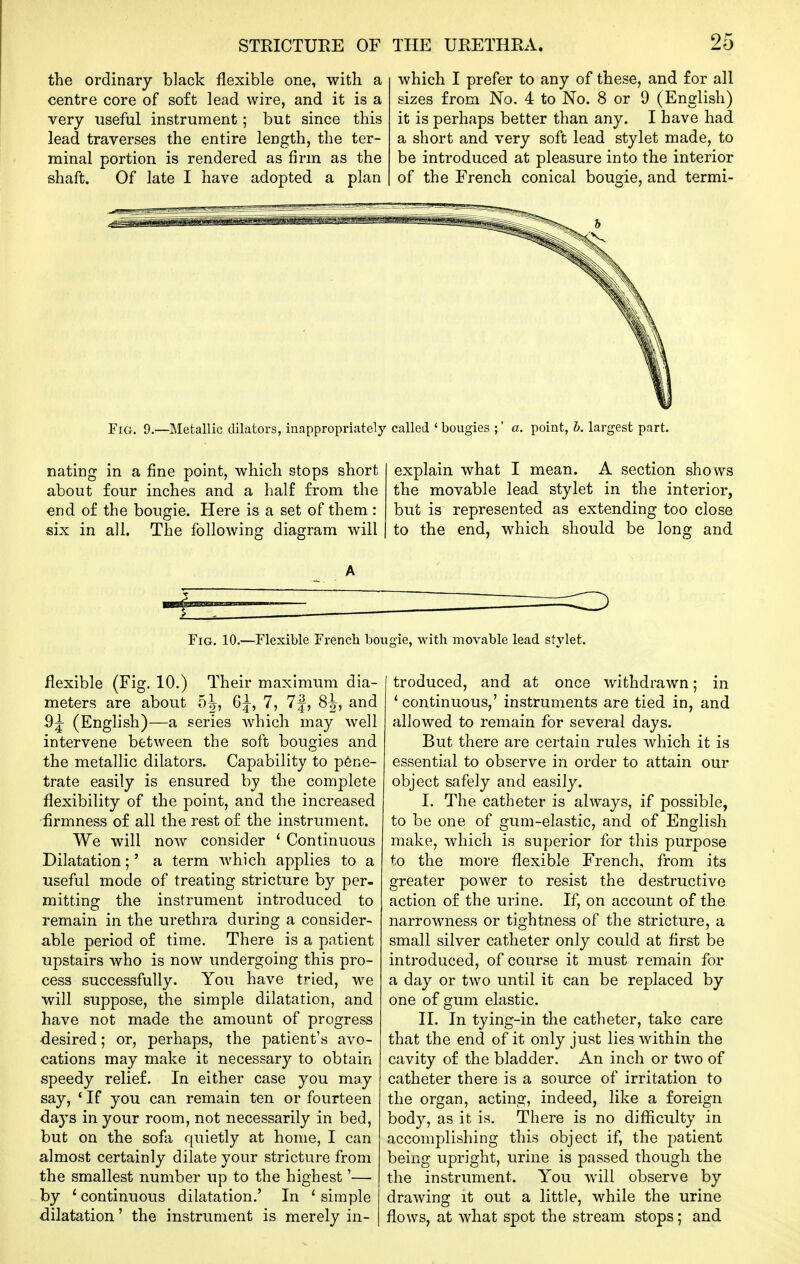 the ordinary black flexible one, with a centre core of soft lead wire, and it is a very useful instrument; but since this lead traverses the entire length, the ter- minal portion is rendered as firm as the shaft. Of late I have adopted a plan which I prefer to any of these, and for all sizes from No. 4 to No. 8 or 9 (English) it is perhaps better than any. I have had a short and very soft lead stylet made, to be introduced at pleasure into the interior of the French conical bougie, and termi- FiG. 9.—Metallic dilators, inappropriately called ' bougies ;' a. point, h. largest part. nating in a fine point, which stops short about four inches and a half from the end of the bougie. Here is a set of them : six in all. The following diagram will explain what I mean. A section shows the movable lead stylet in the interior, but is represented as extending too close to the end, which should be long and Fig. 10.—Flexible French bougie, with movable lead stylet. flexible (Fig. 10.) Their maximum dia- meters are about 5 J, 6^, 7, 7|, 8J, and (English)—a series which may well intervene between the soft bougies and the metallic dilators. Capability to p6ne- trate easily is ensured by the complete flexibility of the point, and the increased •firmness of all the rest of the instrument. We will now consider * Continuous Dilatation;' a term which applies to a useful mode of treating stricture by per- mitting the instrument introduced to remain in the urethra during a consider- able period of time. There is a patient upstairs who is now undergoing this pro- cess successfully. You have t^-ied, we will suppose, the simple dilatation, and have not made the amount of progress desired; or, perhaps, the patient's avo- cations may make it necessary to obtain speedy relief. In either case you may say, ' If you can remain ten or fourteen daj's in your room, not necessarily in bed, but on the sofa quietly at home, I can almost certainly dilate your stricture from the smallest number up to the highest'— by * continuous dilatation.' In * simple dilatation' the instrument is merely in- troduced, and at once withdrawn; in 'continuous,' instruments are tied in, and allowed to remain for several days. But there are certain rules Avhich it is essential to observe in order to attain our object safely and easily. I. The catheter is always, if possible, to be one of gum-elastic, and of English make, which is superior for this purpose to the more flexible French, from its greater power to resist the destructive action of the urine. If, on account of the narrowness or tightness of the stricture, a small silver catheter only could at first be introduced, of course it must remain for a day or two until it can be replaced by one of gum elastic. II. In tying-in the catheter, take care that the end of it only just lies within the cavity of the bladder. An inch or two of catheter there is a source of irritation to the organ, acting, indeed, like a foreign body, as it is. There is no difliculty in accomplishing this object if, the patient being upright, urine is passed though the the instrument. You will observe by drawing it out a little, while the urine flows, at what spot the stream stops; and