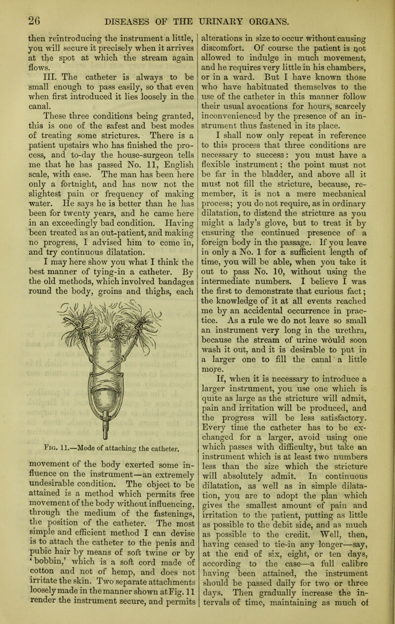 then reintroducing the instrument a little, you will secure it precisely when it arrives at the spot at which the stream again flows. III. The catheter is always to be small enough to pass easily, so that even when first introduced it lies loosely in the canal. These three conditions being granted, this is one of the safest and best modes of treating some strictures. There is a patient upstairs who has finished the pro- cess, and to-day the house-surgeon tells me that he has passed No. 11, English scale, with ease. The man has been here only a fortnight, and has now not the slightest pain or frequency of making water. He says he is better than he has been for twenty years, and he came here in an exceedingly bad condition. Having been treated as an out-patient, and making no progress, I advised him to come in, and try continuous dilatation. I may here show you what I think the best manner of tying-in a catheter. By the old methods, which involved bandages round the body, groins and thighs, each Fig. 11.—Mode of attaching the catheter. movement of the body exerted some in- fluence on the instrument—an extremely undesirable condition. The object to be attained is a method which permits fi:ee movement of the body without influencing, through the medium of the fastenings, the position of the catheter. The most simple and efficient method I can devise is to attach the catheter to the penis and pubic hair by means of soft twine or by 'bobbin,' which is a soft cord made of cotton and not of hemp, and does not irritate the skin. Two separate attachments loosely made in the manner shown at Fig. 11 render the instrument secure, and permits alterations in size to occur without causing discomfort. Of course the patient is Qot allowed to indulge in much movement, and he requires very little in his chambers, or in a ward. But I have known those who have habituated themselves to the use of the catheter in this manner follow their usual avocations for hours, scarcely inconvenienced by the presence of an in- strument thus fastened in its place. I shall now only repeat in reference to this process that three conditions are necessary to success: you must have a flexible instrument; the point must not be fir in the bladder, and above all it must not fill the stricture, because, re- member, it is not a mere mechanical process; you do not require, as in ordinary dilatation, to distend the stricture as you might a lady's glove, but to treat it by ensuring the continued presence of a foreign body in the passage. If you leave in only a No. 1 for a sufficient length of time, you will be able, when you take it out to pass No. 10, without using the intermediate numbers. I believe I was the first to demonstrate that curious fact; the knowledge of it at all events reached me by an accidental occurrence in prac- tice. As a rule we do not leave so small an instrument very long in the urethra, because the stream of urine would soon wash it out, and it is desirable to put in a larger one to fill the canal a little more. If, when it is necessary to introduce a larger instrument, you use one which is quite as large as the stricture will admit, pain and irritation will be produced, and the progress will be less satisfactory. Every time the catheter has to be ex- changed for a larger, avoid using one which passes Avith difficulty, but take an instrument which is at least two numbers less than the size which the stricture will absolutely admit. In continuous dilatation, as well as in simple dilata- tion, you are to adopt the plan which gives the smallest amount of pain and irritation to the patient, putting as little as possible to the debit side, and as much as possible to the credit. Well, then, having ceased to tie-in any longer—say, at the end of six, eight, or ten days, according to the case—a full calibre having been attained, the instrument should be passed daily for two or three days. Then gradually increase the in- tervals of time, maintaining as much oi