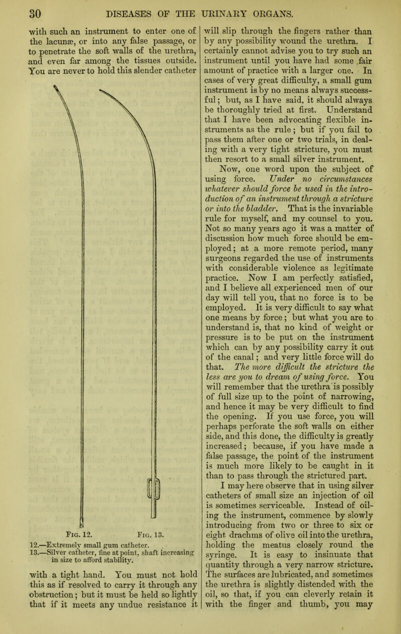 witli such an instrument to enter one o£ the lacunag, or into any false passage, or to penetrate the soft walls o£ the urethra, and even far among the tissues outside. You are never to hold this slender catheter in size to afford stability. with a tight hand. You must not hold this as if resolved to carry it through any obstruction; but it must be held so lightly that if it meets any imdue resistance it will slip through the fingers rather than by any possibility wound the urethra. I certainly cannot advise you to try such an instrument until you have had some fair amount of practice with a larger one. In cases of very great difficulty, a small gum instrument is by no means always success- ful ; but, as I have said, it should always be thoroughly tried at first. Understand that I have been advocating flexible in- struments as the rule ; but if you fail to pass them after one or two trials, in deal- ing with a very tight stricture, you must then resort to a small silver instrument. Now, one word upon the subject of using force. Under no circumstances whatever should force he used in the intro- duction of an instrument through a stricture or into the bladder. That is the invariable rule for myself, and my counsel to you. Not so many years ago it was a matter of discussion how much force should be em- ployed ; at a more remote period, many surgeons regarded the use of instruments with considerable violence as legitimate practice. Now I am perfectly satisfied, and I believe all experienced men of our day will tell you, that no force is to be employed. It is very difficult to say what one means by force; but what you are to understand is, that no kind of weight or pressure is to be put on the instrument which can by any possibility carry it out of the canal; and very little force will do that. The more difficult the stricture the less are you to dream of using force. You will remember that the urethra is possibly of full size up to the point of narrowing, and hence it may be very difficult to find the opening. If you use force, you will perhaps perforate the soft walls on either side, and this done, the difficulty is greatly increased; because, if you have made a false passage, the point of the instrument is much more likely to be caught in it than to pass through the strictured part. I may here observe that in using silver catheters of small size an injection of oil is sometimes serviceable. Instead of oil- ing the instrument, commence by slowly introducing from two or three to six or eight drachms of olive oil into the urethra, holding the meatus closely round the syringe. It is easy to insinuate that quantity through a very narrow stricture. The surfaces are lubricated, and sometimes the urethra is slightly distended with the oil, so that, if you can cleverly retain it with the finger and thumb, you may
