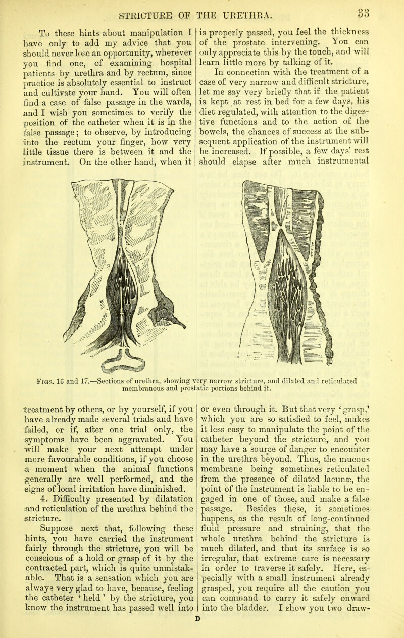 To these hints about manipnlation I have only to add my advice that you should never lose an opportunity, wherever you find one, of examining hospital patients by urethra and by rectum, since practice is absolutely essential to instruct and cultivate your hand. You will often find a case of false passage in the wards, and I wish you sometimes to verify the position of the catheter when it is in the ialse passage; to observe, by introducing into the rectum your finger, how very little tissue there is between it and the instrument. On the other hand, when it is properly passed, you feel the thickness of the prostate intervening. You can only appreciate this by the touch, and will learn little more by talking of it. In connection with the treatment of a case of very narrow and difl^icult stricture, let me say very briefly that if the patient is kept at rest in bed for a few days, his diet regulated, with attention to the diges- tive functions and to the action of the bowels, the chances of success at the sub- sequent application of the instrument will be increased. If possible, a few days' re&t should elapse after much instrumental treatment by others, or by yourself, if you have already made several trials and have failed, or if, after one trial only, the symptoms have been aggravated. You will make your next attempt under more favourable conditions, if you choose a moment when the animal functions generally are well performed, and the signs of local irritation have diminished. 4. Difficulty presented by dilatation ■and reticulation of the urethra behind the stricture. Suppose next that, following these hints, you have carried the instrument fairly through the stricture, you will be conscious of a hold or grasp of it by the contracted part, which is quite unmistak- able. That is a sensation which you are always very glad to have, because, feeling the catheter ' held ' by the stricture, you know the instrument has passed well into or even through it. But that very 'grasp/ which you are so satisfied to feel, makes it less easy to manipulate the point of the catheter beyond the stricture, and you may have a source of danger to encounter in the urethra beyond. Thus, the mucous membrane being sometimes reticulated from the presence of dilated lacunar, the point of the instrument is liable to be en- gaged in one of those, and make a false passage. Besides these, it sometimes happens, as the result of long-continued fluid pressure and straining, that the whole urethra behind the stricture is much dilated, and that its surface is so irregular, that extreme care is necessary in order to traverse it safely. Here, es- pecially with a small instrument already grasped, you require all the caution you can command to carry it safely onward into the bladder. I show you two draw-