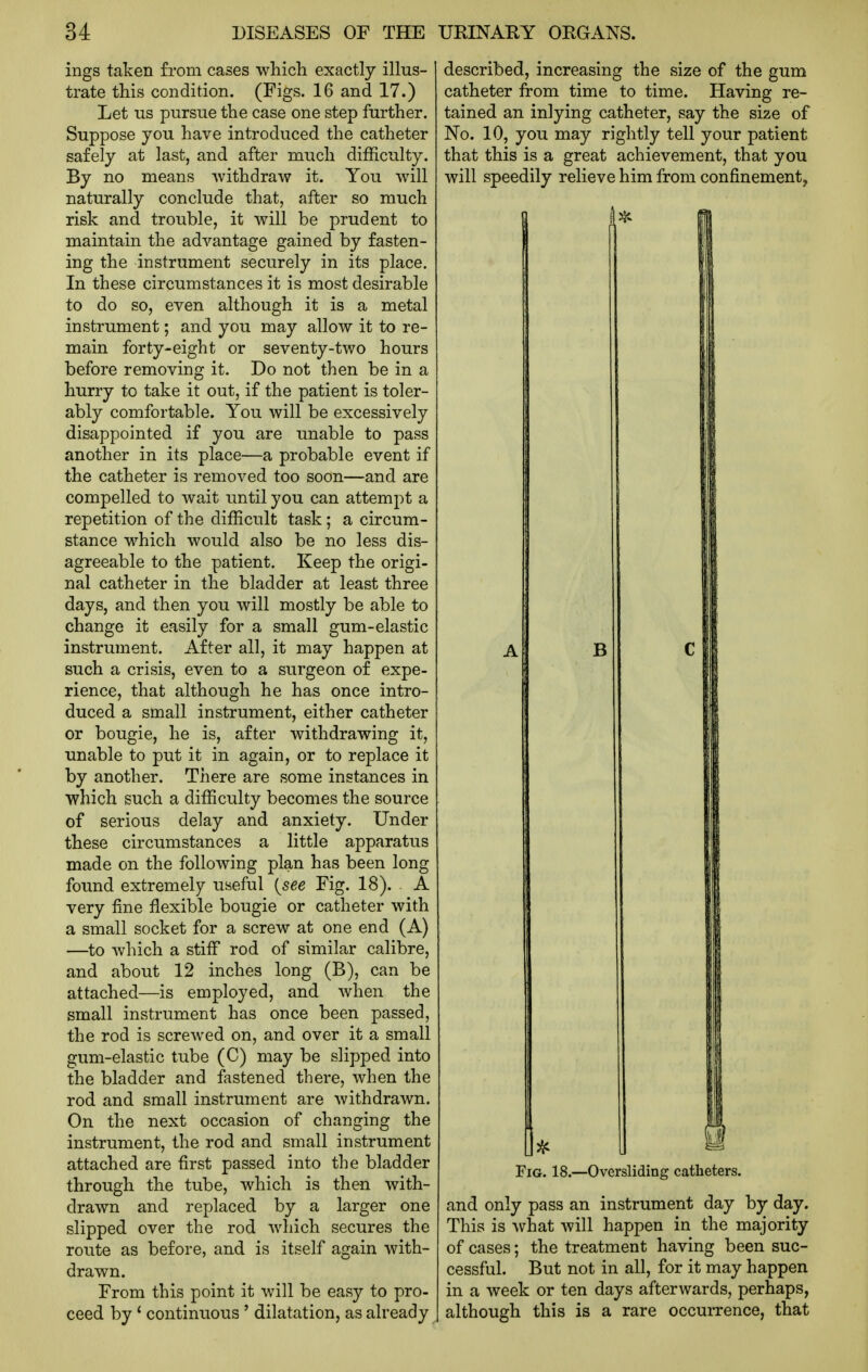 ings taken from cases which exactly illus- trate this condition. (Figs. 16 and 17.) Let us pursue the case one step further. Suppose you have introduced the catheter safely at last, and after much difficulty. By no means withdraw it. You will naturally conclude that, after so much risk and trouble, it will be prudent to maintain the advantage gained by fasten- ing the instrument securely in its place. In these circumstances it is most desirable to do so, even although it is a metal instrument; and you may allow it to re- main forty-eight or seventy-two hours before removing it. Do not then be in a hurry to take it out, if the patient is toler- ably comfortable. You will be excessively disappointed if you are unable to pass another in its place—a probable event if the catheter is removed too soon—and are compelled to wait until you can attempt a repetition of the difficult task; a circum- stance which would also be no less dis- agreeable to the patient. Keep the origi- nal catheter in the bladder at least three days, and then you will mostly be able to change it easily for a small gum-elastic instrument. After all, it may happen at such a crisis, even to a surgeon of expe- rience, that although he has once intro- duced a small instrument, either catheter or bougie, he is, after withdrawing it, unable to put it in again, or to replace it by another. There are some instances in which such a difficulty becomes the source of serious delay and anxiety. Under these circumstances a little apparatus made on the following plan has been long found extremel7 useful {see Fig. 18). A very fine flexible bougie or catheter with a small socket for a screw at one end (A) —to which a stiiF rod of similar calibre, and about 12 inches long (B), can be attached—is employed, and when the small instrument has once been passed, the rod is screwed on, and over it a small gum-elastic tube (C) may be slipped into the bladder and fastened there, when the rod and small instrument are withdrawn. On the next occasion of changing the instrument, the rod and small instrument attached are first passed into the bladder through the tube, which is then with- drawn and replaced by a larger one slipped over the rod which secures the route as before, and is itself again with- drawn. From this point it will be easy to pro- ceed by' continuous ' dilatation, as already described, increasing the size of the gum catheter from time to time. Having re- tained an inlying catheter, say the size of No. 10, you may rightly tell your patient that this is a great achievement, that you will speedily relieve him from confinement, 1* B h Fig. 18.—Oversliding catheters. and only pass an instrument day by day. This is what will happen in the majority of cases; the treatment having been suc- cessful. But not in all, for it may happen in a week or ten days afterwards, perhaps, although this is a rare occurrence, that