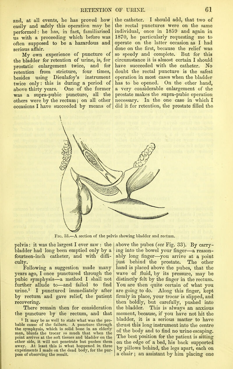 EETENTION and, at all events, he has proved how easily and safely this operation may be performed : he has, in fact, familiarised us with a proceeding which before was often supposed to be a hazardous and serious affair. My own experience of puncture of the bladder for retention of urine, is, for prostatic enlargement twice, and for retention from stricture, four times, besides using Dieulafoy's instrument twice only: this is during a period of above thirty years. One of the former was a supra-pubic puncture, all the others were by the rectum; on all other occasions I have succeeded by means of OF URINE. 61 the catheter. I should add, that two of the rectal punctures were on the same individual, once in 1859 and again in 1870, he particularly requesting me to operate on the latter occasion as I had done on the first, because the relief was so speedy and compiete. But for this circumstance it is almost certain I should have succeeded with the catheter. No doubt the rectal puncture is the safest operation in most cases when the bladder has to be opened. On the other hand, a very considerable enlargement of the prostate makes the supra-pubic operation necessary. In the one case in which I did it for retention, the prostate filled the Fig. 33.—A section of the pelvis showing bladder and rectum. pelvis: it was the largest I ever saw : the bladder had long been emptied only by a fourteen-inch catheter, and with difii- culty. Following a suggestion made many years ago, I once punctured through the pubic symphysis—a method I shall not further allude to—and failed to find urine.^ I punctured immediately after by rectum and gave relief, the patient recovering. There remain then for consideration the puncture by the rectum, and that 1 It may be as well to state what was the pro- bable cause of the failure. A puncture through the symphysis, which is solid bone in an elderly man, blunts the trocar so much that when the point arrives at the soft tissues and bladder on the other side, it will not penetrate but pushes them away. At least this is what happened in three experiments I made on the dead body, for the pur- pose of observing the result. above the pubes (see Fig. 33). By carry- ing into the bowel your finger—a reason- ably long finger—you arrive at a point just behind the prostate. The other hand is placed above the pubes, that the wave of fiuid, by its pressure, may be distinctly felt by the finger in the rectum. You are then quite certain of what you are going to do. Along this finger, kept firmly in place, your trocar is slipped, and then boldly, but carefully, pushed into the bladder. This is always an anxious moment, because, if you have not hit the bladder, it is a serious matter to have thrust this long instrument into the centre of the body and to find no urine escaping. The best position for the patient is sitting on the edge of a bed, his back supported by pillows behind, the legs apart, each on a chair ; an assistant by him placing one