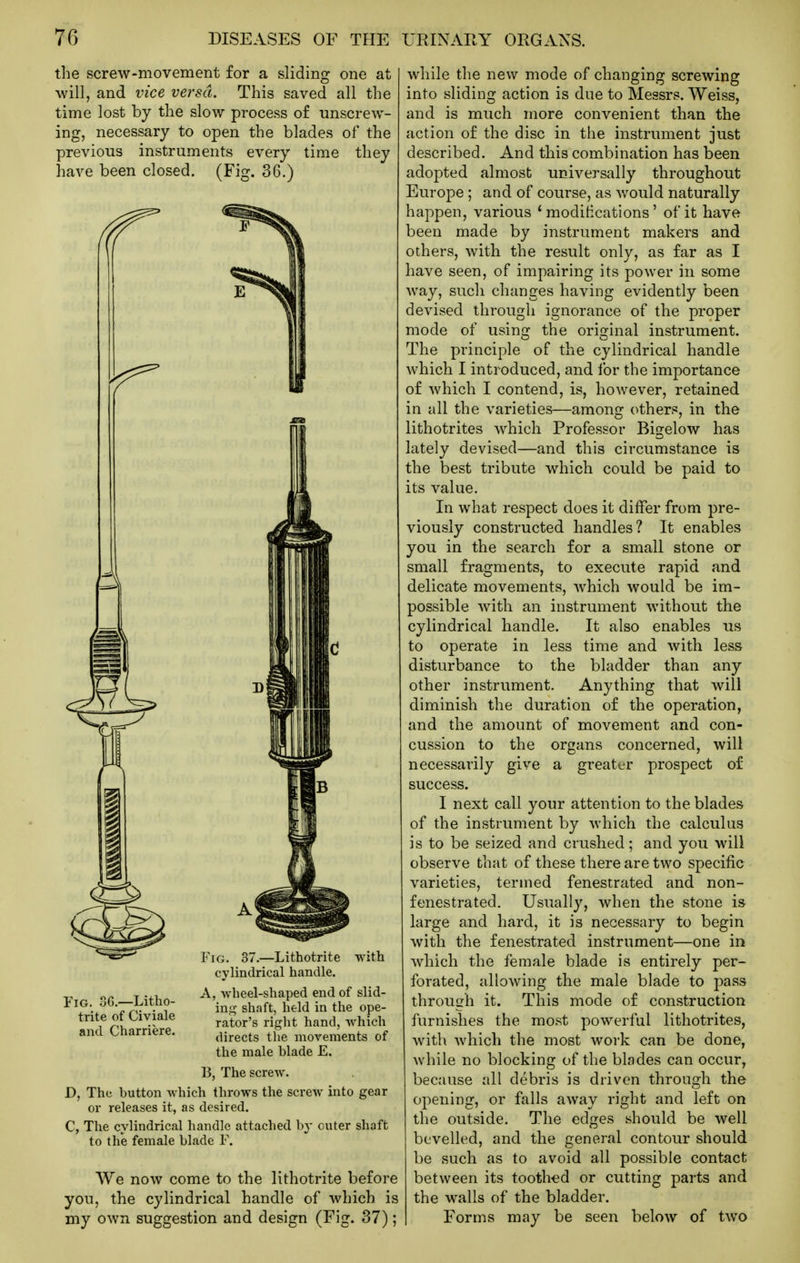 the screw-movement for a sliding one at will, and vice versa. This saved all the time lost by the slow process of unscrew- ing, necessary to open the blades of the previous instruments every time they have been closed. (Fig. 36.) Fig. .SG.—Litho- trite of Civiale and Charriere. Fig. 37.—Lithotrite with cylindrical handle. A, vvheel-shaped end of slid- in.£^ shaft, held in the ope- rator's right hand, which directs the movements of the male hlade E. B, The screw. D, The button which throws the screw into gear or releases it, as desired. C, The cylindrical handle attached b}- outer shaft to the female blade F. We now come to the lithotrite before you, the cylindrical handle of which is my own suggestion and design (Fig. 37); while the new mode of changing screwing into sliding action is due to Messrs. Weiss, and is much more convenient than the action of the disc in the instrument just described. And this combination has been adopted almost universally throughout Europe ; and of course, as would naturally happen, various 'modifications' of it have been made by instrument makers and others, with the result only, as far as I have seen, of impairing its power in some way, such changes having evidently been devised through ignorance of the proper mode of using the original instrument. The principle of the cylindrical handle which I introduced, and for the importance of which I contend, is, however, retained in all the varieties—among others, in the lithotrites which Professor Bigelow has lately devised—and this circumstance is the best tribute which could be paid to its value. In what respect does it differ from pre- viously constructed handles? It enables you in the search for a small stone or small fragments, to execute rapid and delicate movements, which would be im- possible with an instrument without the cylindrical handle. It also enables us to operate in less time and with less disturbance to the bladder than any other instrument. Anything that will diminish the duration of the operation, and the amount of movement and con- cussion to the organs concerned, will necessarily give a greater prospect of success. I next call your attention to the blades of the instrument by which the calculus is to be seized and crushed; and you will observe that of these there are two specific varieties, termed fenestrated and non- fenestrated. Usually, when the stone i» large and hard, it is necessary to begin with the fenestrated instrument—one in which the female blade is entirely per- forated, allowing the male blade to pass through it. This mode of construction furnishes the most powerful lithotrites, with which the most work can be done, while no blocking of the blades can occur, because all debris is driven through the opening, or falls away right and left on the outside. The edges should be well bevelled, and the general contour should be such as to avoid all possible contact between its toothed or cutting parts and the walls of the bladder. Forms may be seen below of two