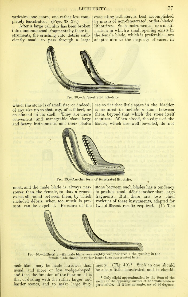 varieties, one more, one rather less com- pletely fenestrated. (Figs. 38, 39.) After a large calculus has been broken into numerous small fragments by these in- struments, the crushing into debris suffi- ciently small to pass through a large evacuating catheter, is best accomplished by means of non-£enestrated, or flat-bladed lithotrites. Such instruments—or a modi- fication in which a small opening exists in the female blade, Avhich is preferable—are adapted also to the majority of cases, in A fenestrated litliotrito. which the stone is of small size, or, indeed, of any size up to that, say, of a filbert, or an almond in its shell. They are more convenient and manageable than large and heavy instruments, and their blades are so flat that little space in the bladder is required to include a stone between them, beyond that whicb the stone itself requires. When closed, the edges of the blades, which are well bevelled, do not Fig. 39.—Another form of fenestrated lithotrite. meet, and the male blade is always nar- rower than the female, so that a groove exists all round between them, by which included debris, when too much is pre- sent, can be expelled. Pressure of the stone between such blades has a tendency to produce small debris rather than large fragments. But there are two chief varieties of these instruments, adapted for two different results required. (1) The Fio. 40.—Lithotrite with male Wade very slightly wedge-shaped : the opening in the female blade should be rather larger than represented here. be made narrower than or less wedge-shaped, male blade may usual, and more and then the function of the instrument is that of dealing with the rather larger and harder stones, and to make large frag- ments. (Fig. 40) ^ Such an one should be also a little fenestrated, and it should, 1 Only slight approximation to the form of the Avedge in the opposing surface of the male blade is permissible. If it has an angle, say of 90 degrees,