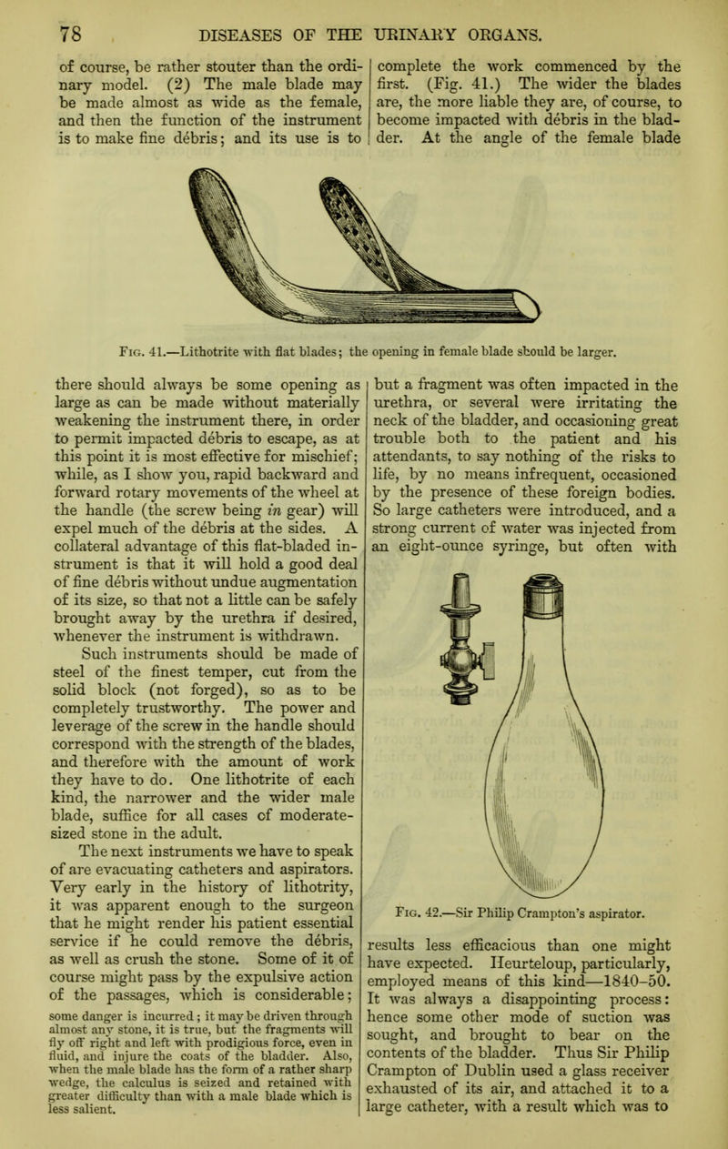 of course, be rather stouter than the ordi- nary model. (2) The male blade may be made almost as Mdde as the female, and then the function of the instrument is to make fine debris; and its use is to ! complete the work commenced by the first. (Fig. 41.) The wider the blades are, the more liable they are, of course, to become impacted with debris in the blad- der. At the angle of the female blade Fig. 41.—Lithotrite with flat blades; the opening in female blade should be larger. there should always be some opening as large as can be made without materially weakening the instrument there, in order to permit impacted debris to escape, as at this point it is most effective for mischief; while, as I show you, rapid backward and forward rotary movements of the wheel at the handle (the screw being in gear) will expel much of the debris at the sides. A collateral advantage of this flat-bladed in- strument is that it will hold a good deal of fine debris without undue augmentation of its size, so that not a little can be safely brought away by the urethra if desired, whenever the instrument is withdrawn. Such instruments should be made of steel of the finest temper, cut from the solid block (not forged), so as to be completely trustworthy. The power and leverage of the screw in the handle should correspond with the strength of the blades, and therefore with the amount of work they have to do. One lithotrite of each kind, the narrower and the wider male blade, suffice for all cases of moderate- sized stone in the adult. The next instruments we have to speak of are evacuating catheters and aspirators. Very early in the history of lithotrity, it was apparent enough to the surgeon that he might render his patient essential service if he could remove the debris, as well as crush the stone. Some of it of course might pass by the expulsive action of the passages, which is considerable; some danger is incurred ; it maybe driven through almost any stone, it is true, but' the fragments will fly oft' right and left -with prodigious force, even in fluid, and injure the coats of the bladder. Also, when the male blade has the fonn of a rather sharp wedge, the calculus is seized and retained with greater difficulty than with a male blade which is less salient. but a fragment was often impacted in the urethra, or several were irritating the neck of the bladder, and occasioning great trouble both to the patient and his attendants, to say nothing of the risks to life, by no means infrequent, occasioned by the presence of these foreign bodies. So large catheters were introduced, and a strong current of water was injected from an eight-ounce syringe, but often with Fig. 42.—Sir Philip Crampton's aspirator. results less efficacious than one might have expected. Heurteloup, particularly, employed means of this kind—1840-50. It was always a disappointing process: hence some other mode of suction was souorht, and brought to bear on the contents of the bladder. Thus Sir Philip Crampton of Dublin used a glass receiver exhausted of its air, and attached it to a large catheter, with a result which was to
