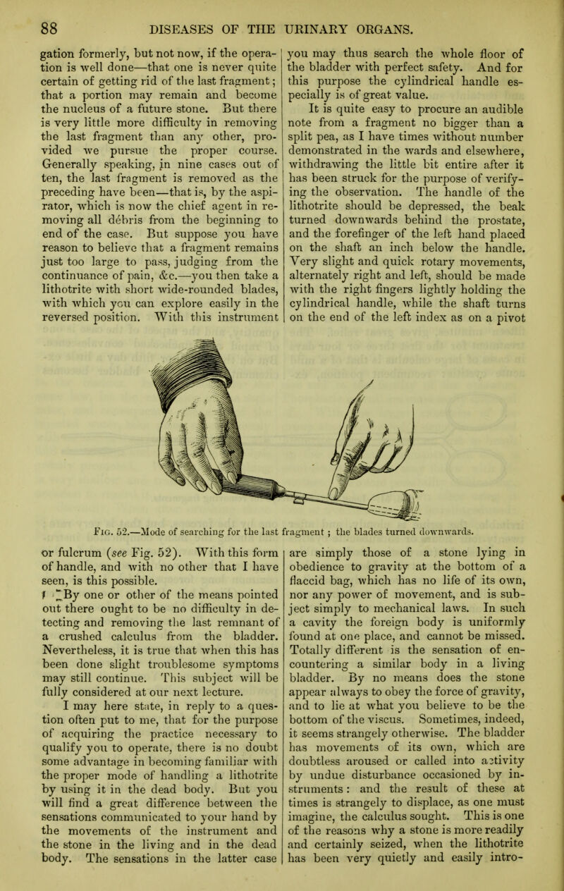 gation formerly, but not now, if the opera- tion is well done—that one is never quite certain of getting rid of tlie last fragment; that a portion may remain and become the nucleus of a future stone. But there is very little more difficulty in removing the last fragment than any other, pro- vided Ave pursue the proper course. Generally speaking, jn nine cases out of ten, the last fragment is removed as the preceding have been—that is, by the aspi- rator, which is now the chief agent in re- moving all debris from the beginning to end of the case. But suppose you have reason to believe that a fragment remains just too large to pass, judging from the continuance of pain, &c.—you then take a lithotrite with short wide-rounded blades, with which you can explore easily in the reversed position. With this instrument you may thus search the whole floor of the bladder with perfect safety. And for this purpose the cylindrical handle es- pecially is of great value. It is quite easy to procure an audible note from a fragment no bigger than a split pea, as I have times without number demonstrated in the wards and elsewhere, withdrawing the little bit entire after it has been struck for the purpose of verify- ing the observation. The handle of the lithotrite should be depressed, the beak turned downwards behind the prostate, and the forefinger of the left hand placed on the shaft an inch below the handle. Very slight and quick rotary movements, alternately right and left, should be made with the right fingers lightly holding the cylindrical handle, while the shaft turns on the end of the left index as on a pivot 5^ Fig. 52.—Mode of searching for the last fragment ; the blades turned downwards. or fulcrum {see Fig. 52). With this form of handle, and with no other that I have seen, is this possible. f lIBy one or other of the means pointed out there ought to be no difficulty in de- tecting and removing the last remnant of a crushed calculus from the bladder. Nevertheless, it is true that when this has been done slight troublesome symptoms may still continue. This subject will be fully considered at our next lecture. I may here state, in repl}^ to a ques- tion often put to me, that for the purpose of acquiring the practice necessary to qualify you to operate, there is no doubt some advantage in becoming familiar with the proper mode of handling a lithotrite by using it in the dead body. But you will find a great difference between the sensations communicated to your hand by the movements of the instrument and the stone in the livinc: and in the dead body. The sensations in the latter case are simply those of a stone lying in obedience to gravity at the bottom of a flaccid bag, which has no life of its own, nor any power of movement, and is sub- ject simply to mechanical laws. In such a cavity the foreign body is uniformly found at one place, and cannot be missed. Totally different is the sensation of en- countering a similar body in a living bladder. By no means does the stone appear always to obey the force of gravity, and to lie at what you believe to be the bottom oftheviscus. Sometimes, indeed, it seems strangely otherwise. The bladder has movements of its own, which are doubtless aroused or called into a3tivity by undue disturbance occasioned by in- struments : and the result of these at times is strangely to displace, as one must imagine, the calculus sought. This is one of the reasons why a stone is more readily and certainly seized, when the lithotrite has been very quietly and easily intro-