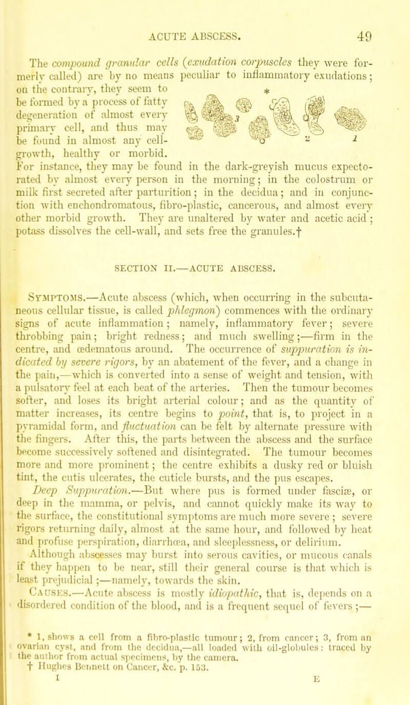 The compound granular cells (exudation corpuscles they were for- merlv called) ai'e by no means peculiar to inflammatory exudations; on the contrary, they seem to + be formed by a process of fatty degeneration of almost every '^^'^^SSs.j -(Si^t^^-!, primaiT cell, and thus may 1^ f#Js^®)^ be found in almost any cell- fe§ Vi^ a l growth, healthy or morbid. For instance, they may be found in the dark-gi'eyish mucus expecto- rated by almost eveiy person in the morning; in the colostrum or miliv first secreted after parturition ; in the decidua; and in conjunc- tion with enchondromatons, fibro-plastic, cancerous, and almost ever}' other morbid growth. They ai'e unaltered by water and acetic acid ; potass cUssolves the ceU-wall, and sets free the granules.f SECTION II.—ACUTE ABSCESS. SyMPTOJis.—Acute abscess (which, when occurring in the subcuta- neous cellular tissue, is called phlegmon') commences with the ordinary signs of acute inflammation; namely, inflammatory fever; severe throbbing pain; bright redness; and much swelling ;■—firm in the centre, and cedematous around. The occurrence of suppuration is in- dicated bi/ severe rigors, by an abatement of the fevei', and a change in the pain,—which is converted into a sense of weight and tension, with a pulsatoiy feel at each beat of the arteries. Then the tumour becomes softer, and loses its bright arterial colour; and as the quantity of matter increases, its centre begins to point, that is, to project in a pyramidal foi-m, and fluctuation can be felt by alternate pressure with the fingers. After this, the parts between the abscess and the surface become successively softened and disintegi'ated. Tlie tumour becomes more and more prominent; the centre exliibits a dusky red or bluish tint, t!ie cutis ulcerates, the cuticle bursts, and the ])us escapes. Beep Suppuratiort.—But where pus is formed under fascias, or deep in tiie mamma, or pelvis, and cannot quicivly make its wav to the surface, the constitutional symptoms are much more severe ; severe rigors returning daily, almost at the same liour, and followed by heat and Y)rof'use ])erspiration, diarrhoea, and sleeplessness, or delirium. Although al)scesses may burst into serous cavities, or mucous canals if they hap|)en to be near, still their general course is that which is leiist prejudicial ;—namely, towards the skin. Cacsks.—Acute abscess is mostly idiopathic, that is, dcyiends on a disordered condition of the blood, and is a frequent setpicl of fevers ;— * 1, shows n cell from a fibro-plastic tumour; 2, Trom cnnccr; 3, from an ovarian cyst, ami frum the dccidim,—all loaded with oil-globules: traced by the author froiii aclnul specimoiis, by the camera. t Hughes Beiinetl on Cancer, &c. p. 153. 1 E
