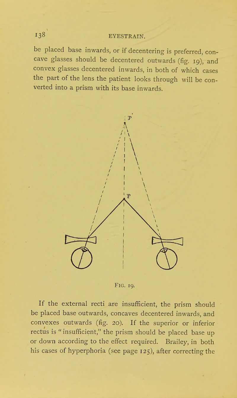 138^ EYESTRAIN. be placed base inwards, or if decentering is preferred, con- cave glasses should be decentered outwards (fig. 19), and convex glasses decentered inwards, in both of which cases the part of the lens the patient looks through will be con- verted into a prism with its base inwards. Fig. 19. If the external recti are insufficient, the prism should be placed base outwards, concaves decentered inwards, and convexes outwards (fig. 20). If the superior or inferior rectus is insufficient, the prism should be placed base up or down according to the effect required. Brailey, in both his cases of hyperphoria (see page 125), after correcting the