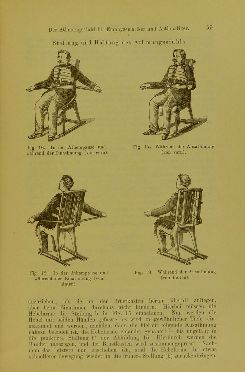 Stellung und Haltung des Athmungsstuhls Fig 18. In der Athempause und Fig. 19. Während der Ausathmung während der Einathrnung (von (von hinten), hinten). anzuziehen, bis sie um den Brustkasten herum überall anliegen, aber beim Einathmen durchaus nicht hindern. Hierbei müssen die Hebelarme die Stellung b in Fig. 15 einnehmen. Nun werden die Hebel mit beiden Händen gefasst; es wird in gewöhnlicher Tiefe ein- geathmet und werden, nachdem dann die hierauf folgende Ausathmung nahezu beendet ist, die Hebelarme einander genähert — bis ungefähr iu die punktirte Stellung b' der Abbildung 15. Hierdurch werden die Bänder angezogen, und der Brustkasten wird zusammengepresst. Nach- dem «las letztere nun geschehen ist, sind die Hebelarme in etwas schnellerer Bewegung wieder in die frühere Stellung (b) zurückzubringen.