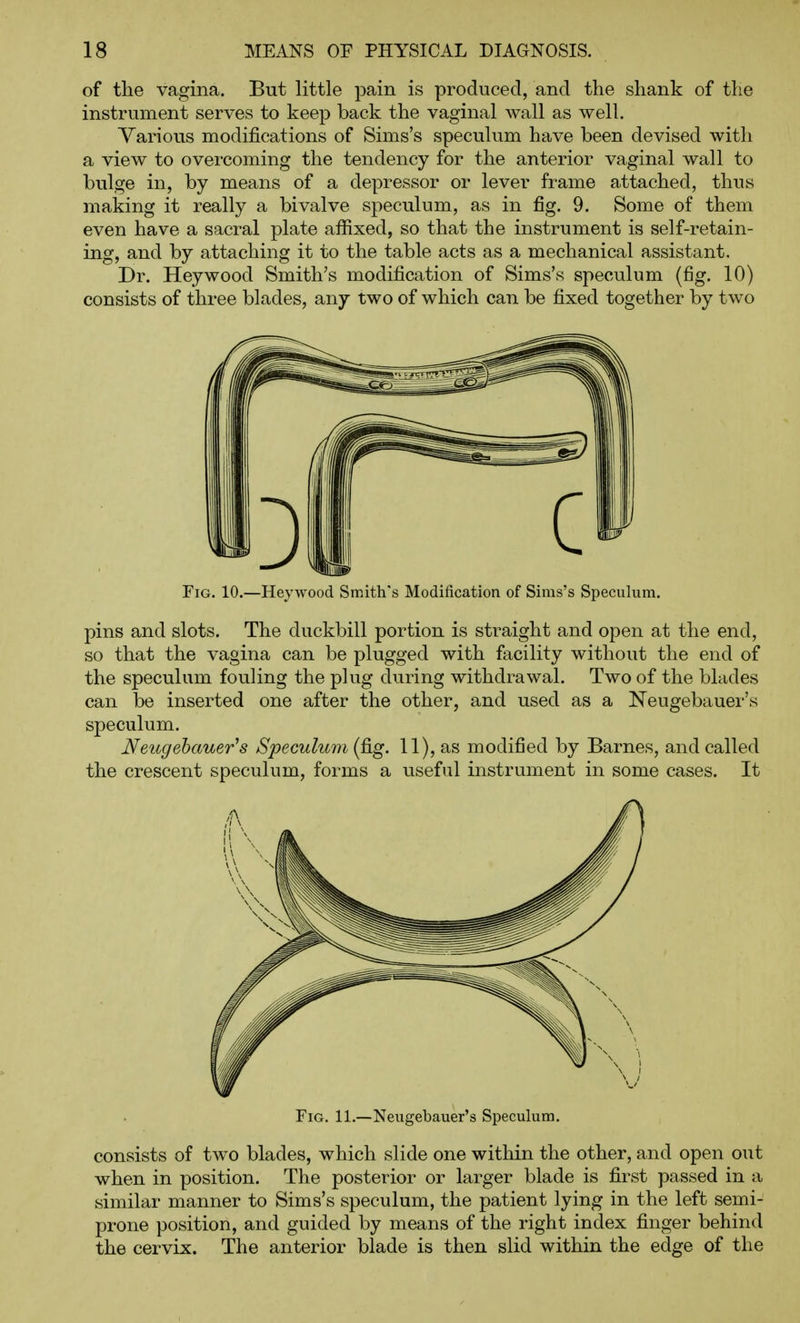of the vagina. But little pain is produced, and the shank of the instrument serves to keep back the vaginal wall as well. Yarious modifications of Sims's speculum have been devised with a view to overcoming the tendency for the anterior vaginal wall to bulge in, by means of a depressor or lever frame attached, thus making it really a bivalve speculum, as in fig. 9. Some of them even have a sacral plate afiixed, so that the instrument is self-retain- ing, and by attaching it to the table acts as a mechanical assistant. Dr. Hey wood Smith's modification of Sims's speculum (fig. 10) consists of three blades, any two of which can be fixed together by two Fig. 10.—Hejwood Smith's Modification of Sims's Speculum. pins and slots. The duckbill portion is straight and open at the end, so that the vagina can be plugged with facility without the end of the speculum fouling the plug during withdrawal. Two of the blades can be inserted one after the other, and used as a Neugebauer's speculum. Neugebauer's Speculum {^g. 11), as modified by Barnes, and called the crescent speculum, forms a useful instrument in some cases. It Fig. 11.—Neugebauer's Speculum. consists of two blades, which slide one within the other, and open out when in position. The posterior or larger blade is first passed in a similar manner to Sims's speculum, the patient lying in the left semi- prone position, and guided by means of the right index finger behind the cervix. The anterior blade is then slid within the edge of the