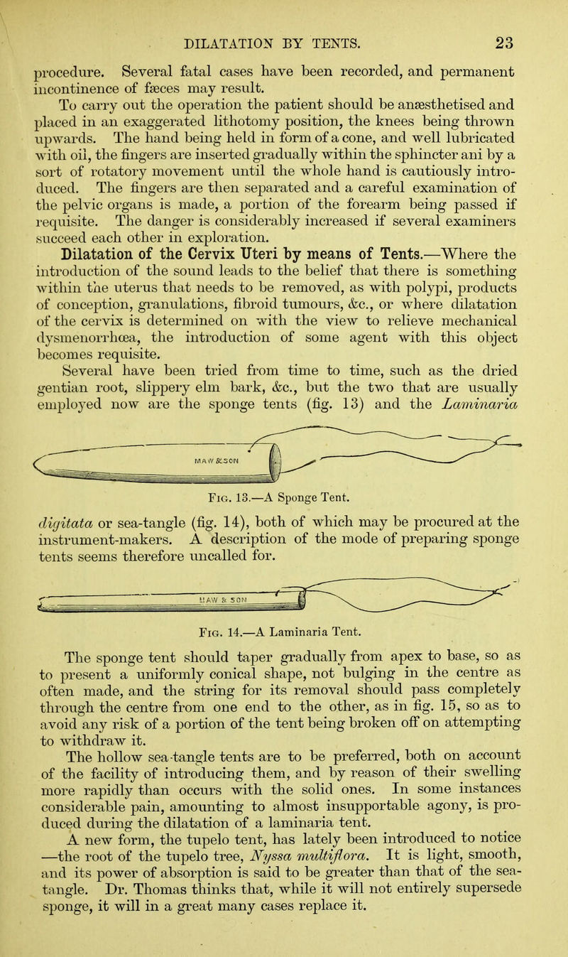procedure. Several fatal cases have been recorded, and permanent incontinence of faeces may result. To carry out the operation the patient should be anaesthetised and placed in an exaggerated lithotomy position, the knees being thrown upwards. The hand being held in form of a cone, and well lubricated with oil, the fingers are inserted gradually within the sphincter ani by a sort of rotatory movement until the whole hand is cautiously intro- duced. The fingers are then separated and a careful examination of the pelvic organs is made, a portion of the forearm being passed if i-equisite. The danger is considerably increased if several examiners succeed each other in exploration. Dilatation of the Cervix Uteri by means of Tents.—Where the introduction of the sound leads to the belief that there is something within the uterus that needs to be removed, as with polypi, products of conception, granulations, fibroid tumours, &c., or where dilatation of the cervix is determined on with the view to relieve mechanical dysmenorrhcea, the introduction of some agent with this object becomes requisite. Several have been tried from time to time, such as the dried gentian root, slippery elm bark, &c., but the two that are usually employed now are the sponge tents (fig. 13) and the Laminaria FiCx. 13.—A Sponge Tent. digitata or sea-tangle (fig. 14), both of which may be procured at the instrument-makers. A description of the mode of preparing sponge tents seems therefore uncalled for. —^ f.l AW & 5 0M Fig. 14.—A Laminaria Tent. The sponge tent should taper gradually from apex to base, so as to present a uniformly conical shape, not bulging in the centre as often made, and the string for its removal should pass completely through the centre from one end to the other, as in fig. 15, so as to avoid any risk of a portion of the tent being broken off on attempting to withdraw it. The hollow sea-tangle tents are to be preferred, both on account of the facility of introducing them, and by reason of their swelling more rapidly than occurs with the solid ones. In some instances considerable pain, amounting to almost insupportable agony, is pro- duced during the dilatation of a laminaria tent. A new form, the tupelo tent, has lately been introduced to notice —the root of the tupelo tree, Nyssa multiflora. It is light, smooth, and its power of absorption is said to be greater than that of the sea- tangle. Dr. Thomas thinks that, while it will not entirely supersede sponge, it will in a great many cases replace it.