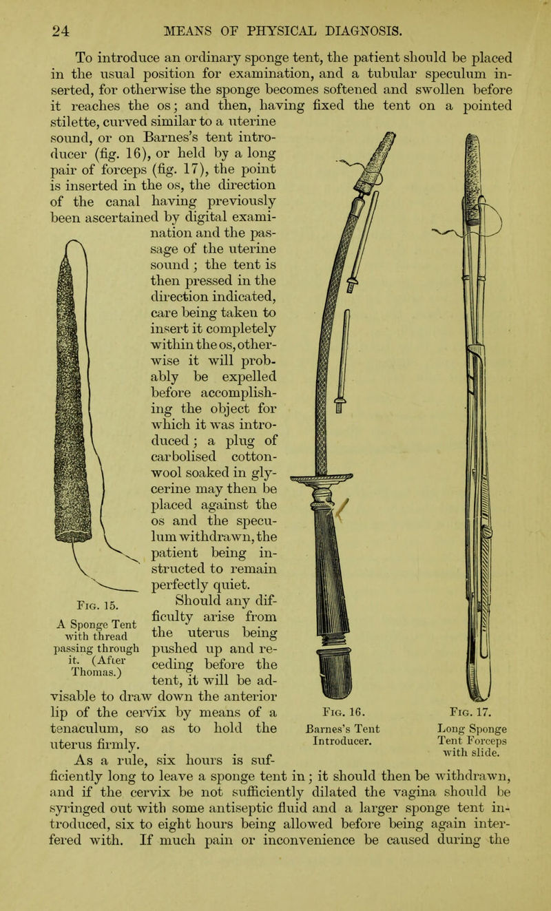 To introduce an ordinary sponge tent, the patient should be placed in the usual position for examination, and a tubular speculum in- serted, for otherwise the sponge becomes softened and swollen before it reaches the os; and then, having fixed the tent on a pointed stilette, curved similar to a uterine sound, or on Barnes's tent intro- ducer (fig. 16), or held by a long pair of forceps (fig. 17), the point is inserted in the os, the direction of the canal having previously been ascertained by digital exami- nation and the pas- sage of the uterine sound ; the tent is then pressed in the direction indicated, care being taken to insert it completely within the os, other- wise it will prob- ably be expelled before accomplish- ing the object for which it was intro- duced ; a plug of carbolised cotton- wool soaked in gly- cerine may then be placed against the OS and the specu- lum withdrawn, the patient being in- structed to remain perfectly quiet. Should any dif- ficulty arise from the uterus being pushed up and re- ceding before the tent, it will be ad- visable to draw down the anterior lip of the cervix by means of a tenaculum, so as to hold the uterus firmly. As a rule, six hours is suf- ficiently long to leave a sponge tent in; it should then be withdrawn, and if the cervix be not sufficiently dilated the vagina should be syringed out with some antiseptic fluid and a larger sponge tent in- troduced, six to eight hours being allowed before being again inter- fered with. If much pain or inconvenience be caused during the 1/ Fig. 15. A Sponge Tent with thread passing through it. (After Thomas.) Fig. 16. Barnes's Tent Introducer. J Fig. 17. Long Sponge Tent Forceps with slide.