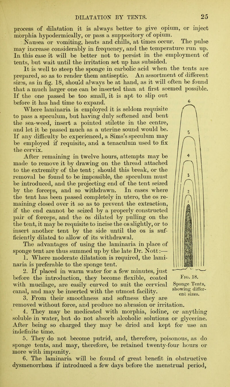 process of dilatation it is always better to give opium, or inject morphia hypodermically, or pass a suppository of opium. Nausea or vomiting, heats and chills, at times occur. The pulse may increase considerably in frequency, and the temperatiu^e run up. In this case it will be better not to persist in the employment of tents, but wait until the irritation set up has subsided. It is well to steep the sponge in carbolic acid when the tents are prepared, so as to render them antiseptic. An assortment of different sizes, as in fig. 18, should always be at hand, as it will often be found that a much larger one can be inserted than at first seemed possible. If the one passed be too small, it is apt to slip out before it has had time to expand. Where laminaria is employed it is seldom requisite to pass a speculum, but having duly softened and bent the sea-weed, insert a pointed stilette in the centre, and let it be passed much as a uterine sound would be. If any difficulty be experienced, a Sims's speculum may be employed if requisite, and a tenaculum used to fix the cervix. After remaining in twelve hours, attempts may be made to remove it by drawing on the thread attached to the extremity of the tent; should this break, or the removal be found to be impossible, the speculum must be introduced, and tlie projecting end of the tent seized by the forceps, and so withdrawn. In cases where the tent has been passed completely in utero, the os re- maining closed over it so as to prevent the extraction, if the end cannot be seized by a properly constructed pair of forceps, and the os dilated by jDulling on the the tent, it may be requisite to incise the os slightly, or to insert another tent by the side until the os is suf- ficiently dilated to allow of its withdrawal. The advantages of using the laminaria in place of sponge tent are thus summed up by the late Dr. Nott:— 1. Where moderate dilatation is required, the lami- naria is preferable to the sponge tent. 2. If placed in warm water for a few minutes, just before the introduction, they become flexible, coated with mucilage, are easily curved to suit the cervical canal, and may be inserted with the utmost facility. 3. From their smoothness and softness they are I'emoved without force, and produce no abrasion or irritation. 4. They may be medicated with morphia, iodine, or anything soluble in water, but do not absorb alcoholic solutions or glycerine. After being so charged they may be dried and kept for use an indefinite time. 5. They do not become putrid, and, thei^efore, poisonous, as do sponge tents, and may, therefore, be retained twenty-four hours or more with impunity. 6. The laminaria will be found of great benefit in obstructive dysmenorrhcea if introduced a few days before the menstrual period, Fig. 18. Sponge Tents, showing- differ- ent sizes.