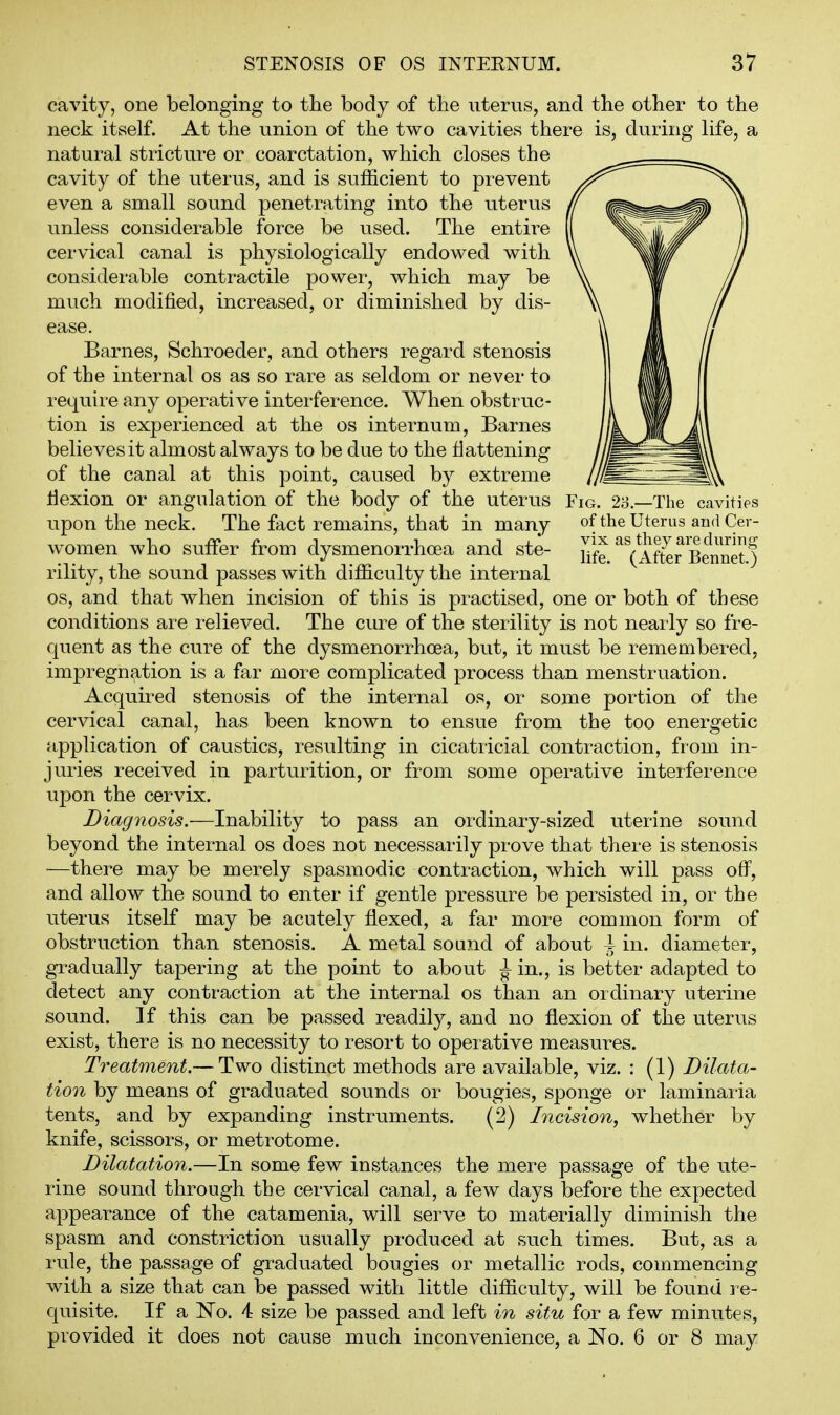 Fig. 23.—The cavities of the Uterus aud Cer- vix as they are during life. (After Bennet.) cavity, one belonging to the body of the uterus, and the other to the neck itself. At the union of the two cavities there is, during life, a natural stricture or coarctation, which closes the cavity of the uterus, and is sufficient to prevent even a small sound penetrating into the uterus unless considerable force be used. The entire cervical canal is physiologically endowed with considei-able contractile power, which may be much modified, increased, or diminished by dis- ease. Barnes, Schroeder, and others regard stenosis of the internal os as so rare as seldom or never to require any operative interference. When obstruc- tion is experienced at the os internum, Barnes believes it almost always to be due to the fiattening of the canal at this point, caused by extreme liexion or angulation of the body of the uterus upon the neck. The fact remains, that in many w^omen who suffer from dysmenorrhoea and ste- rility, the sound passes with difficulty the internal OS, and that when incision of this is practised, one or both of these conditions are relieved. The cure of the sterility is not neaily so fre- quent as the cure of the dysmenorrhoea, but, it must be remembered, impregnation is a far more complicated process than menstruation. Acquired stenosis of the internal os, or some portion of the cervical canal, has been known to ensue from the too energetic application of caustics, resulting in cicatricial contraction, from in- juries received in parturition, or from some operative interference upon the cervix. Diagnosis.—Insibility to pass an ordinary-sized uterine sound beyond the internal os does not necessarily prove that there is stenosis —there may be merely spasmodic contraction, which will pass off, and allow the sound to enter if gentle pressure be persisted in, or the uterus itself may be acutely flexed, a far more common form of obstruction than stenosis. A metal sound of about i in. diameter, gradually tapering at the point to about ^ in., is better adapted to detect any contraction at the internal os than an ordinary uterine sound. If this can be passed readily, and no flexion of the uterus exist, there is no necessity to resort to operative measures. Treatment.— Two distinct methods are available, viz. : (1) Dilata- tion by means of graduated sounds or bougies, sponge or laminaria tents, and by expanding instruments. (2) Incision, whether by knife, scissors, or metrotome. Dilatation.—In some few instances the mere passage of the ute- rine sound through the cervical canal, a few days before the expected appearance of the catamenia, will serve to materially diminish the spasm and constriction usually produced at such times. But, as a rule, the passage of graduated bougies or metallic rods, commencing with a size that can be passed with little difficulty, will be found i^e- quisite. If a No. 4 size be passed and left in situ for a few minutes, provided it does not cause much inconvenience, a No. 6 or 8 may