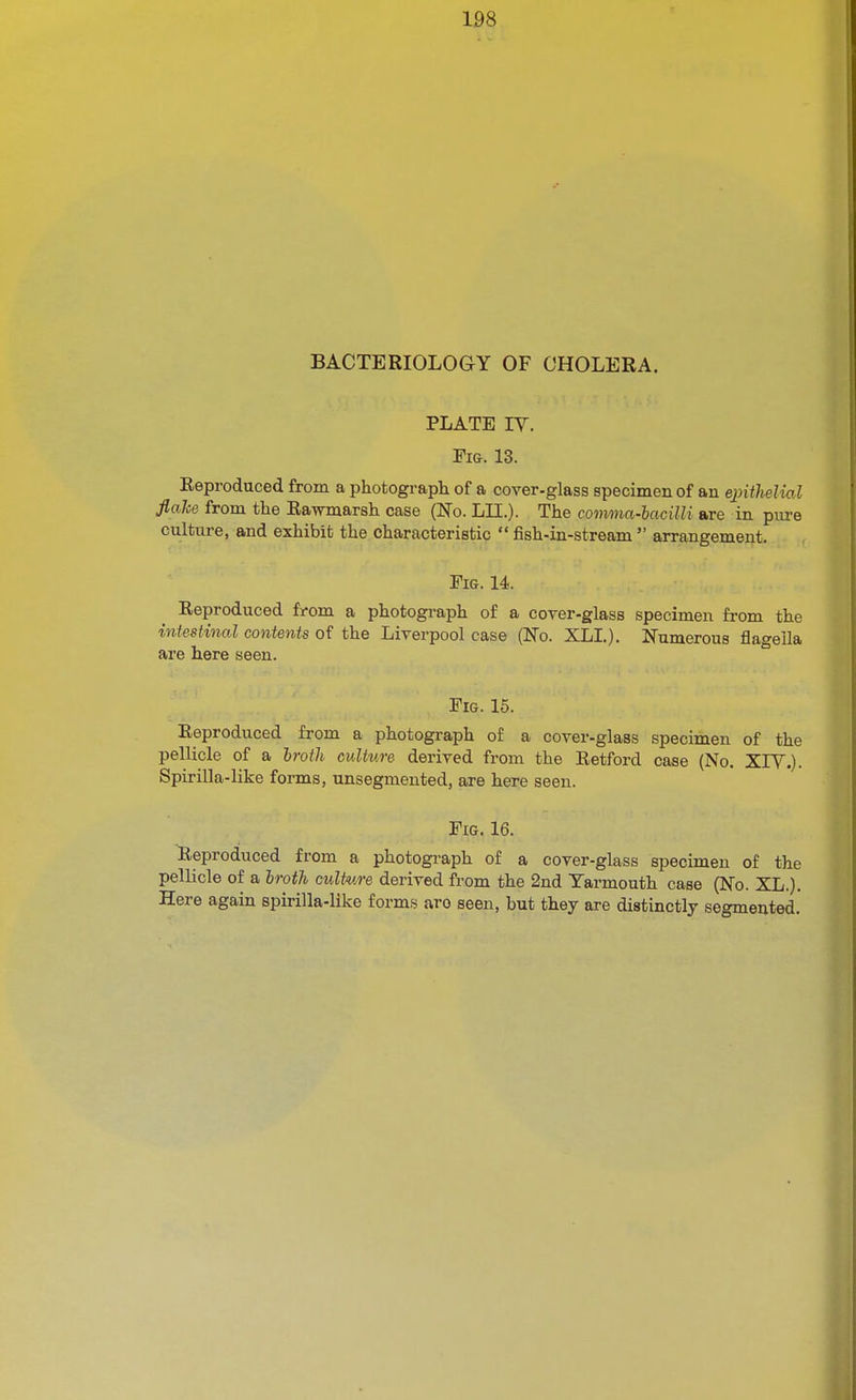 BACTERIOLOGY OF CHOLERA. PLATE IV. Fig. 13. Eeproduced from a photograph of a cover-glass specimen of au epiiheliol flake from the Ra-w^marsh case (No. LII.). The comma-bacilU are in piu-e culture, and exhibit the characteristic  fish-in-stream  arrangement. Fig. 14. Reproduced from a photograph of a cover-glass specimen from the intestinal contents of the Liverpool case (No. XLL). Numerous flageila are here seen. Fig. 15. Eeproduced from a photograph of a cover-glass specimen of the pellicle of a Iroth culture derived from the Retford case (No. XIY.). Spirilla-like forms, unsegmented, are here seen. Fig. 16. Reproduced from a photograph of a cover-glass specimen of the pellicle of a hroth culture derived from the 2nd Yarmouth case (No. XL.). Here again spirilla-like forms arc seen, but they are distinctly segmented.