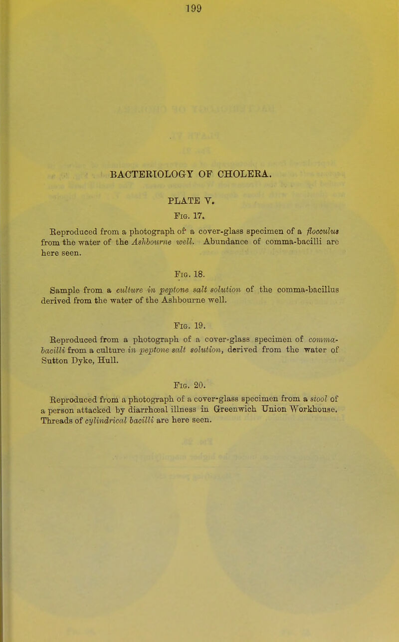 BACTERIOLOGY OF CHOLERA. PLATE V. Fig. 17. Eeproduced from a photograpli of a cover-glass specimen of a flocculus from the water of the Aslibourne well. Abundance of comma-bacilli are here seen. Fig. 18. Sample from a culture in peptone salt solution of the comma-bacillus derived from the water of the Ashbourne well. Fig. 19. Eeproduced from a photograph of a cover-glass specimen of comma- bacilli from a culture in peptone salt solution, derived from the water of Sutton Dyke, Hull. Fig. 20. Eeproduced from a photograph of a cover-glass specimen from a stool of a person attacked by diarrhceal illness in Grreenwich Union Workhouse. Threads of cylind/rical bacilli are here seen.