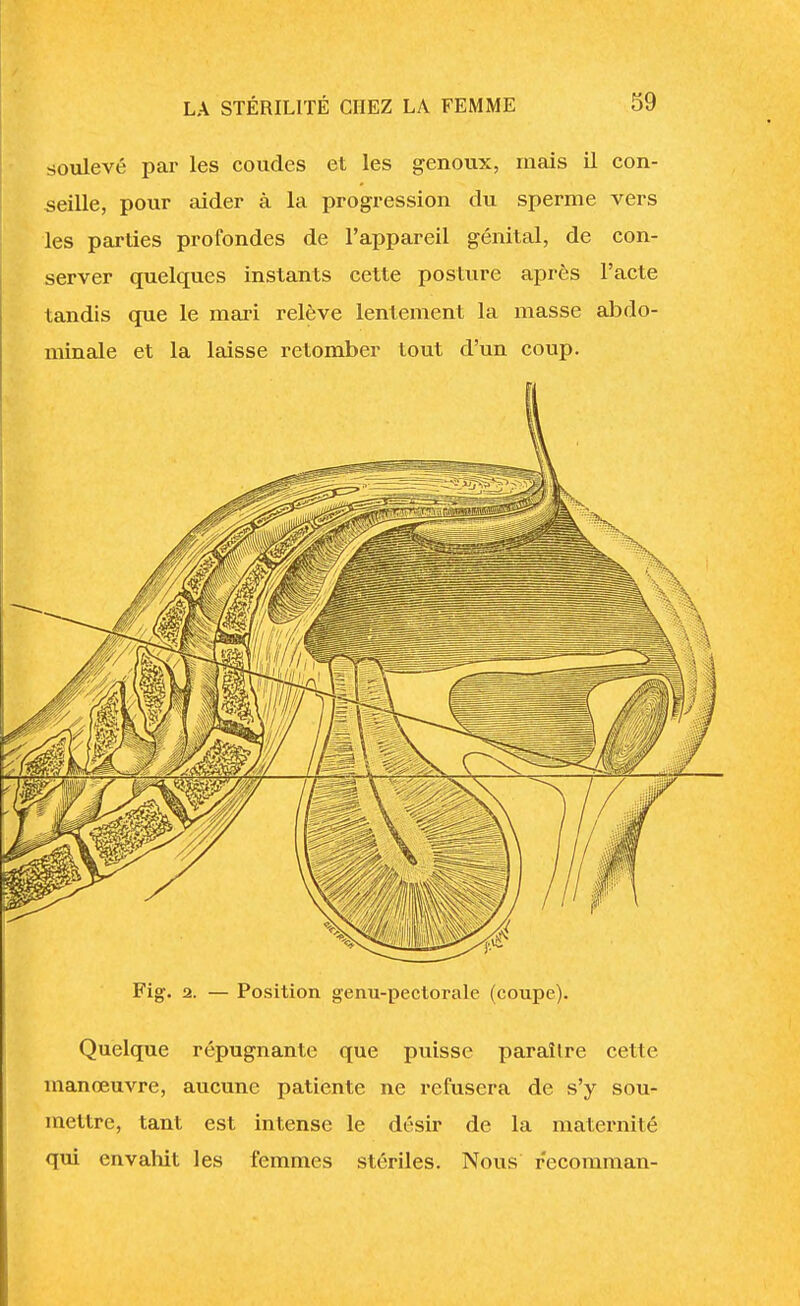 soulevé par les coudes et les genoux, mais il con- seille, pour aider à la progression du sperme vers les parties profondes de l'appareil génital, de con- server quelques instants cette posture après l'acte tandis que le mari relève lentement la masse abdo- minale et la laisse retomber tout d'un coup. Quelque répugnante que puisse paraître cette manœuvre, aucune patiente ne refusera de s'y sou- mettre, tant est intense le désir de la maternité qui envahit les femmes stériles. Nous recomman-