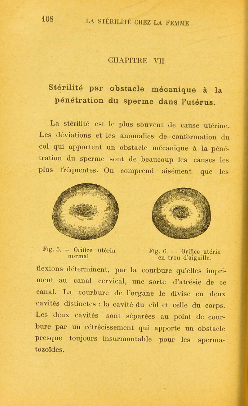 CHAPITRE VII Stérilité par obstacle mécanique à la pénétration du sperme dans l'utérus. La stérilité est le plus souvent de cause utérine. Les déviations et les anomalies de conformation du col qui apportent un obstacle mécanique à la péné- tration du sperme sont de beaucoup les causes les plus fréquentes- On comprend aisément que les flexions déterminent, par la courbure qu'elles impri- ment au canal cervical, une sorte d'atrésie de ce canal. La courbure de l'organe le divise en deux cavités distinctes : la cavité du col et celle du corps. Les deux cavités sont séparées au point de cour- bure par un rétrécissement qui apporte un obstacle presque toujours insurmontable pour les sperma- tozoïdes. Fig. 5. — Orifice utérin normal. Fig. 6. — Orifice utérin en trou d'aiguille.