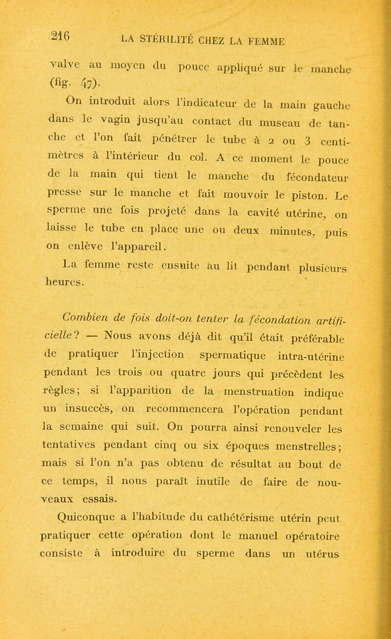 valve au moyen du pouce appliqué sur le manche (%• 47). On introduit alors l'indicateur de la main gauche dans le vagin jusqu'au contact du museau de tan- che et l'on fait pénétrer le tube à 2 ou 3 centi- mètres à l'intérieur du col. A ce moment le pouce de la main qui tient le manche du fécondateur presse sur le manche et fait mouvoir le piston. Le sperme une fois projeté dans la cavité utérine, on laisse le tube en place une ou deux minutes, puis on enlève l'appareil. La femme reste ensuite au lit pendant plusieurs heures. Combien de fois doit-on tenter la fécondation artifi- cielle'} — Nous avons déjà dit qu'il était préférable de pratiquer l'injection spermatique intra-utérine pendant les trois ou quatre jours qui précèdent les règles; si l'apparition de la menstruation indique un insuccès, on recommencera l'opération pendant la semaine qui suit. On pourra ainsi renouveler les tentatives pendant cinq ou six époques menstrelles ; mais si l'on n'a pas obtenu de résultat au bout de ce temps, il nous paraît inutile de faire de nou- veaux essais. Quiconque a l'habitude du cathétérisme utérin peut pratiquer cette opération dont le manuel opératoire consiste à introduire du sperme dans un utérus