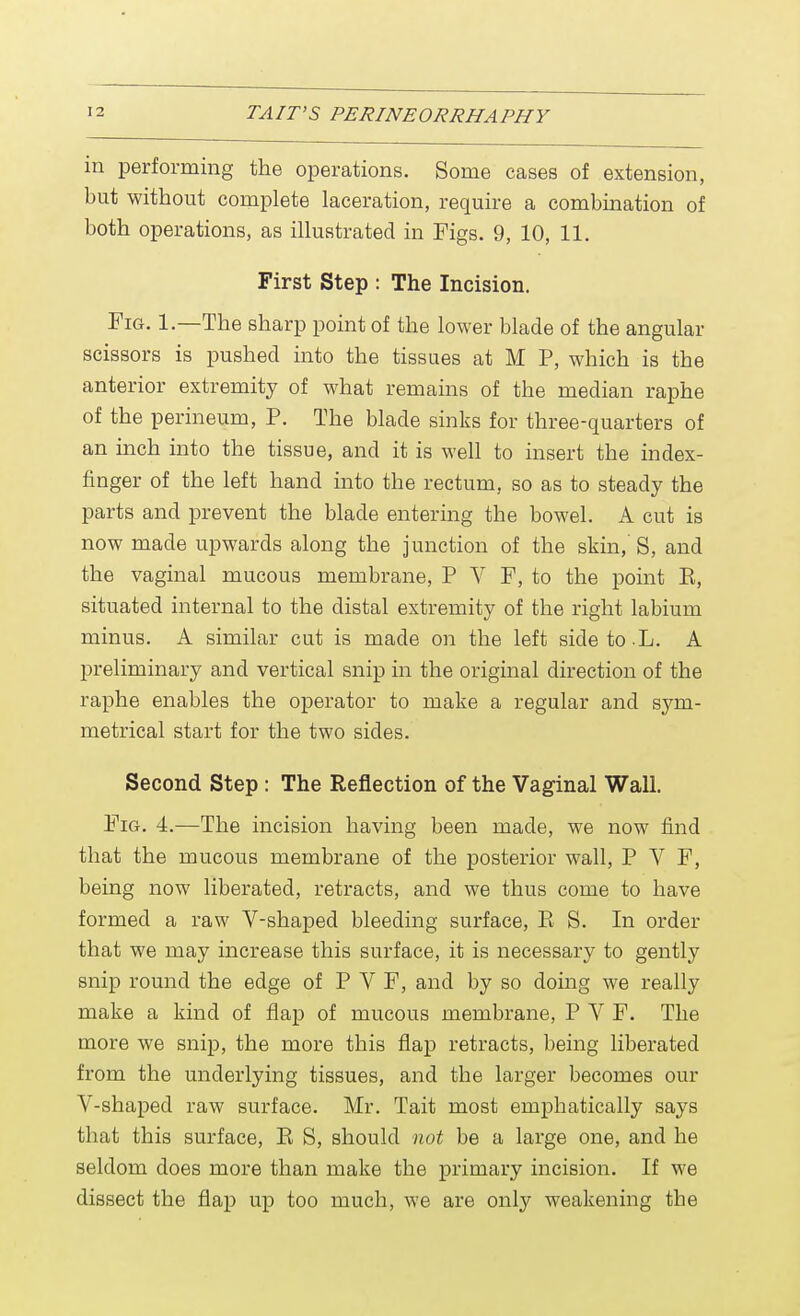 in performing the operations. Some cases of extension, but without complete laceration, require a combination of both operations, as illustrated in Figs. 9, 10, 11. First Step : The Incision. Fig. 1.—The sharp point of the lower blade of the angular scissors is pushed into the tissues at M P, which is the anterior extremity of what remains of the median raphe of the perineum, P. The blade sinks for three-quarters of an inch into the tissue, and it is well to insert the index- finger of the left hand into the rectum, so as to steady the parts and prevent the blade entering the bowel. A cut is now made upwards along the junction of the skin,' S, and the vaginal mucous membrane, P V F, to the point K, situated internal to the distal extremity of the right labium minus. A similar cut is made on the left side to L. A preliminary and vertical snip in the original direction of the raphe enables the operator to make a regular and sym- metrical start for the two sides. Second Step : The Reflection of the Vaginal Wall. Fig. 4.—The incision having been made, we now find that the mucous membrane of the posterior wall, P V F, being now liberated, retracts, and we thus come to have formed a raw V-shaped bleeding surface, E S. In order that we may increase this surface, it is necessary to gently snip round the edge of P V F, and by so doing we really make a kind of flap of mucous membrane, P V F. The more we snip, the more this flap retracts, being liberated from the underlying tissues, and the larger becomes our V-shaped raw surface. Mr. Tait most emphatically says that this surface, E S, should not be a large one, and he seldom does more than make the primary incision. If we dissect the flap up too much, we are only weakening the