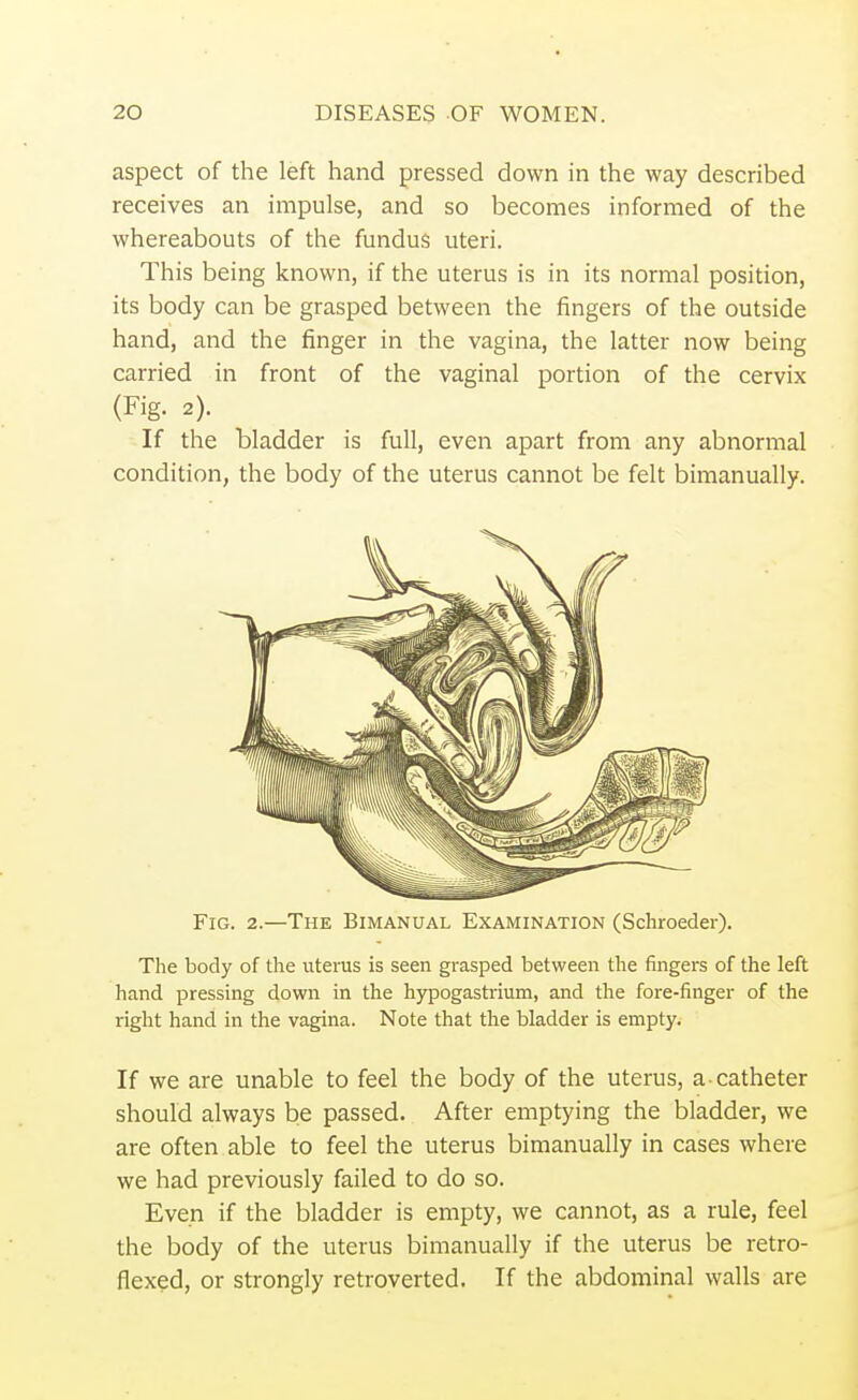 aspect of the left hand pressed down in the way described receives an impulse, and so becomes informed of the whereabouts of the fundus uteri. This being known, if the uterus is in its normal position, its body can be grasped between the fingers of the outside hand, and the finger in the vagina, the latter now being carried in front of the vaginal portion of the cervix If the bladder is full, even apart from any abnormal condition, the body of the uterus cannot be felt bimanually. Fig. 2.—The Bimanual Examination (Schroeder). The body of the uterus is seen grasped between the fingers of the left hand pressing down in the hypogastrium, and the fore-finger of the right hand in the vagina. Note that the bladder is empty. If we are unable to feel the body of the uterus, a catheter should always be passed. After emptying the bladder, we are often able to feel the uterus bimanually in cases where we had previously failed to do so. Even if the bladder is empty, we cannot, as a rule, feel the body of the uterus bimanually if the uterus be retro- flexed, or strongly retroverted. If the abdominal walls are (Fig. 2).