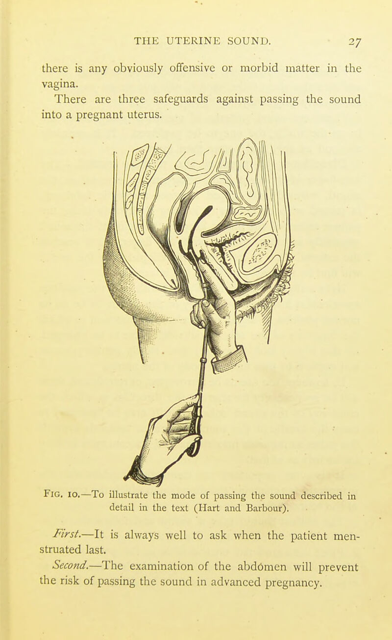 there is any obviously offensive or morbid matter in the vagina. There are three safeguards against passing the sound into a pregnant uterus. Fig. 10.—To illustrate the mode of passing the sound described in detail in the text (Hart and Barbour). First.—It is always well to ask when the patient men- struated last. Second.—The examination of the abdomen will prevent the risk of passing the sound in advanced pregnancy.