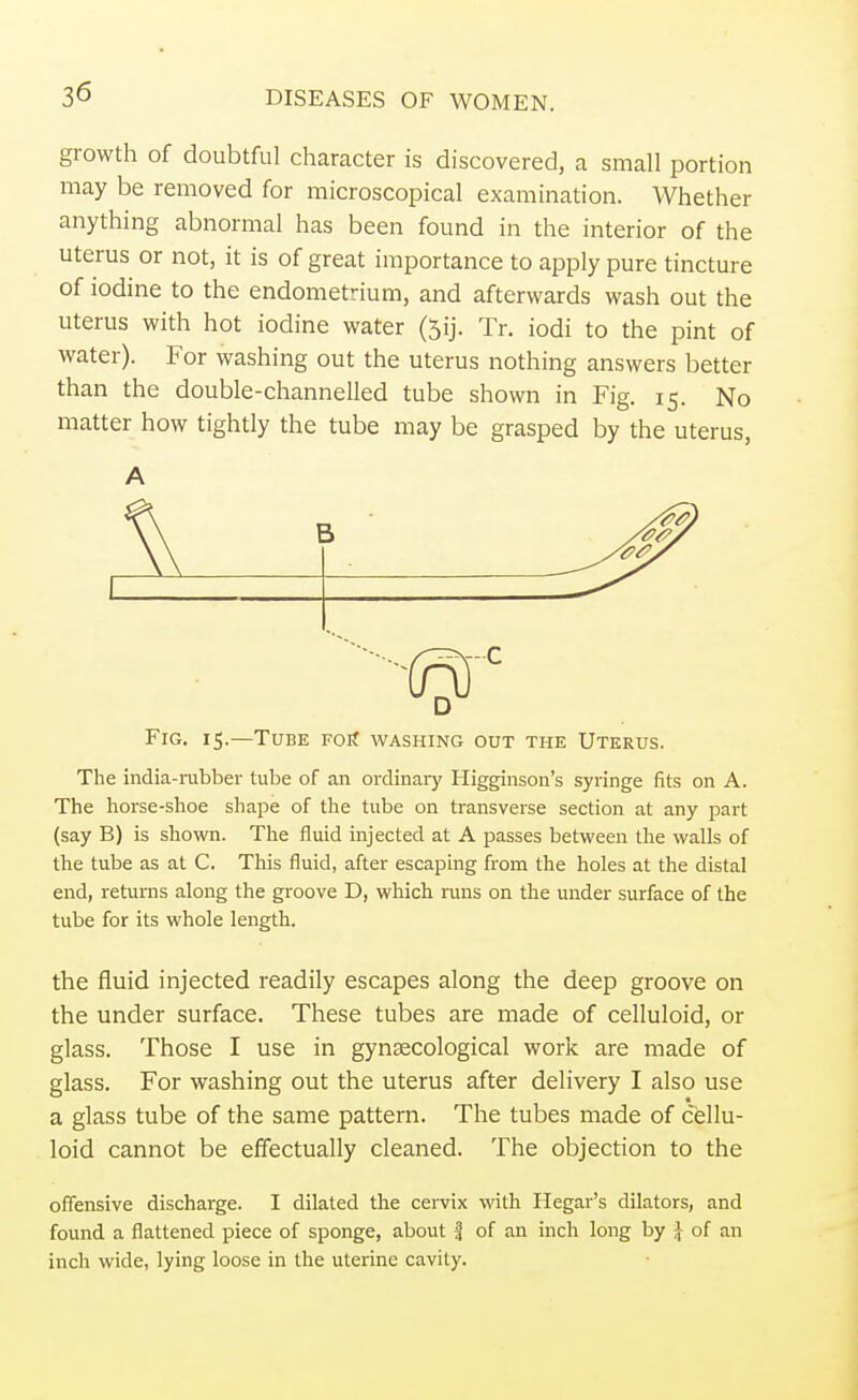 growth of doubtful character is discovered, a small portion may be removed for microscopical examination. Whether anything abnormal has been found in the interior of the uterus or not, it is of great importance to apply pure tincture of iodine to the endometrium, and afterwards wash out the uterus with hot iodine water (5ij. Tr. iodi to the pint of water). For washing out the uterus nothing answers better than the double-channelled tube shown in Fig. 15. No matter how tightly the tube may be grasped by the uterus, A Fig. 15.—Tube for washing out the Uterus. The india-rubber tube of an ordinary Higginson's syringe fits on A. The horse-shoe shape of the tube on transverse section at any part (say B) is shown. The fluid injected at A passes between the walls of the tube as at C. This fluid, after escaping from the holes at the distal end, returns along the groove D, which runs on the under surface of the tube for its whole length. the fluid injected readily escapes along the deep groove on the under surface. These tubes are made of celluloid, or glass. Those I use in gynaecological work are made of glass. For washing out the uterus after delivery I also use a glass tube of the same pattern. The tubes made of cellu- loid cannot be effectually cleaned. The objection to the offensive discharge. I dilated the cervix with Hegar's dilators, and found a flattened piece of sponge, about | of an inch long by £ of an inch wide, lying loose in the uterine cavity.