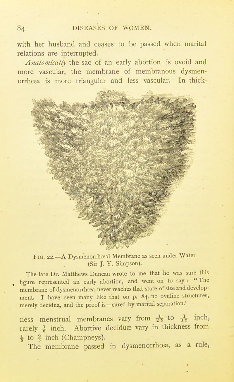 with her husband and ceases to be passed when marital relations are interrupted. Anatomically the sac of an early abortion is ovoid and more vascular, the membrane of membranous dysmen- orrhcea is more triangular and less vascular. In thick- Fig. 22.—A Dysmenorrhoeal Membrane as seen under Water (Sir J. Y. Simpson). The late Dr. Matthews Duncan wrote to me that he was sure this , figure represented an early abortion, and went on to say : The membrane of dysmenorrhea never reaches that state of size and develop- ment. I have seen many like that on p. 84, no ovuline structures, merely decidua, and the proof is—cured by marital separation. ness menstrual membranes vary from j\ to ^ inch, rarely | inch. Abortive decidua? vary in thickness from ■| to f inch (Champneys). The membrane passed in dysmenorrhoea, as a rule,