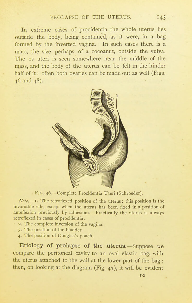 In extreme cases of procidentia the whole uterus lies outside the body, being contained, as it were, in a bag formed by the inverted vagina. In such cases there is a mass, the size perhaps of a cocoanut, outside the vulva. The os uteri is seen somewhere near the middle of the mass, and the body of the uterus can be felt in the hinder half of it; often both ovaries can be made out as well (Figs. 46 and 48). Fig. 46.—Complete Procidentia Uteri (Schroeder). Note.—1. The retroflexed position of the uterus; this position is the invariable rule, except when the uterus has been fixed in a position of anteflexion previously by adhesions. Practically the uterus is always retroflexed in cases of procidentia. 2. The complete inversion of the vagina. 3. The position of the bladder. 4. The position of Douglas's pouch. Etiology of prolapse of the uterus Suppose we compare the peritoneal cavity to an oval elastic bag, with the uterus attached to the wall at the lower part of the bag; then, on looking at the diagram (Fig. 47), it will be evident 10