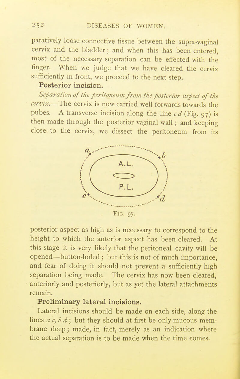 paratively loose connective tissue between the supra-vaginal cervix and the bladder; and when this has been entered, most of the necessary separation can be effected with the finger. When we judge that we have cleared the cervix sufficiently in front, we proceed to the next step. Posterior incision. Separation of the peritoneum from the posterior aspect of the cervix.—The cervix is now carried well forwards towards the pubes. A transverse incision along the line cd (Fig. 97) is then made through the posterior vaginal wall; and keeping close to the cervix, we dissect the peritoneum from its Fig. 97. posterior aspect as high as is necessary to correspond to the height to which the anterior aspect has been cleared. At this stage it is very likely that the peritoneal cavity will be opened—button-holed ; but this is not of much importance, and fear of doing it should not prevent a sufficiently high separation being made. The cervix has now been cleared, anteriorly and posteriorly, but as yet the lateral attachments remain. Preliminary lateral incisions. Lateral incisions should be made on each side, along the lines a c, b d; but they should at first be only mucous mem- brane deep; made, in fact, merely as an indication where the actual separation is to be made when the time comes.