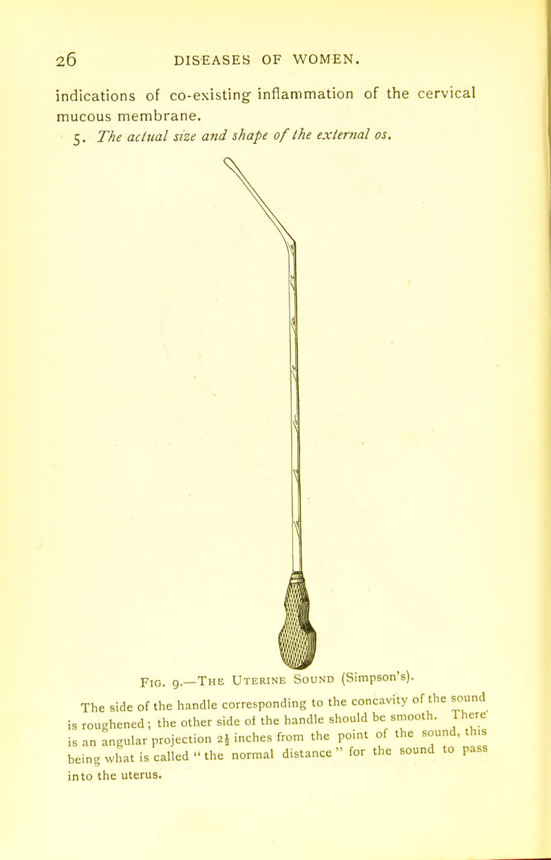 indications of co-existing inflammation of the cervical mucous membrane. 5. The actual size and shape of the external os. Fig. 9.—The Uterine Sound (Simpson's). The side of the handle corresponding to the concavity of the sound is roughened; the other side oi the handle should be smooth. There is an angular projection 2^ inches from the point of the sound, th.s being what is called the normal distance for the sound to pass into the uterus.