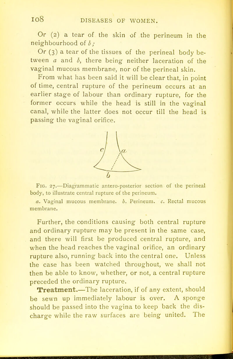 io8 Or (2) a tear of the skin of the perineum in the neighbourhood of b ; Or (3) a tear of the tissues of the perineal body be- tween a and b, there being neither laceration of the vaginal mucous membrane, nor of the perineal skin. From what has been said it will be clear that, in point of time, central rupture of the perineum occurs at an earlier stage of labour than ordinary rupture, for the former occurs while the head is still in the vaginal canal, while the latter does not occur till the head is passing the vaginal orifice. Fig. 27.—Diagrammatic antero-posterior section of the perineal body, to illustrate central rupture of the perineum. a. Vaginal mucous membrane, h. Perineum, c. Rectal mucous membrane. Further, the conditions causing both central rupture and ordinary rupture may be present in the same case, and there will first be produced central rupture, and when the head reaches the vaginal orifice, an ordinary rupture also, running back into the central one. Unless the case has been watched throughout, we shall not then be able to know, whether, or not, a central rupture preceded the ordinary rupture. Treatment.—The laceration, if of any extent, should be sewn up immediately labour is over. A sponge should be passed into the vagina to keep back the dis- charge while the raw surfaces are being united. The